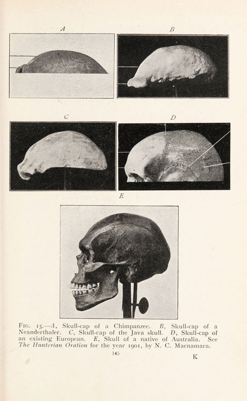 c D Fig. 15.—A, Skull-cap of a Chimpanzee. B, Skull-cap of a Neanderthaler. C, Skull-cap of the Java skull. D, Skull-cap of an existing European. E, Skull of a native of Australia. See The Hunterian Oration for the year 1901, by N. C. Maenamara. 145 K