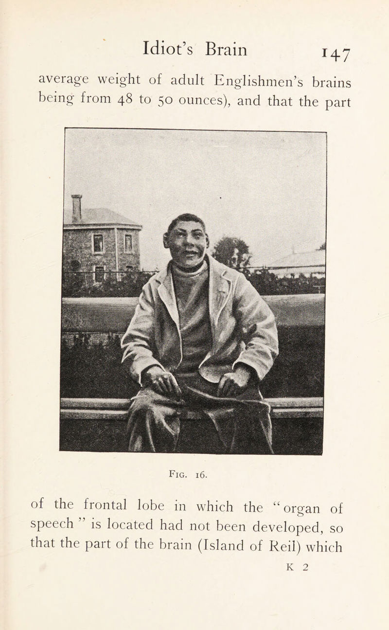 Idiot’s Brain T+7 average weight of adult Englishmen’s brains being from 48 to 50 ounces), and that the part Fig. 16. of the frontal lobe in which the “ organ of speech is located had not been developed, so that the part of the brain (Island of Reil) which K 2