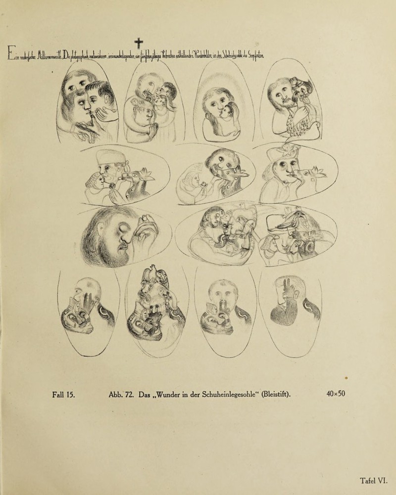 Fall 15. Abb. 72. Das „Wunder in der Schuheinlegesohle“ (Bleistift). 40x50