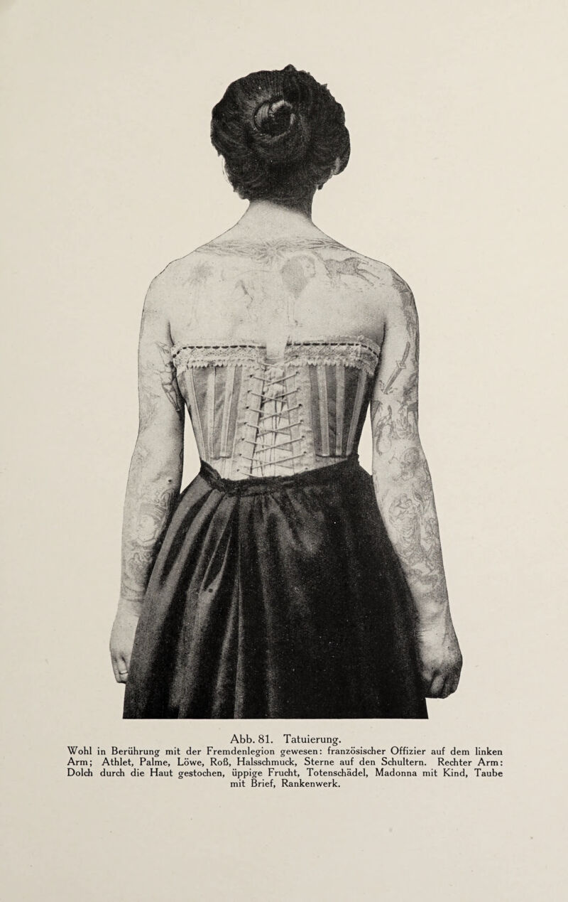 Wohl in Berührung mit der Fremdenlegion gewesen: französischer Offizier auf dem linken Arm; Athlet, Palme, Löwe, Roß, Halsschmuck, Sterne auf den Schultern. Rechter Arm: Dolch durch die Haut gestochen, üppige Frucht, Totenschädel, Madonna mit Kind, Taube mit Brief, Rankenwerk.