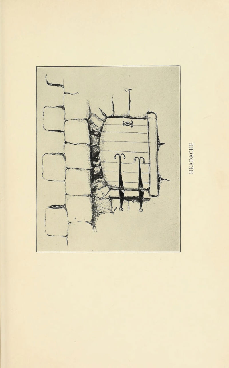 HEADACHE