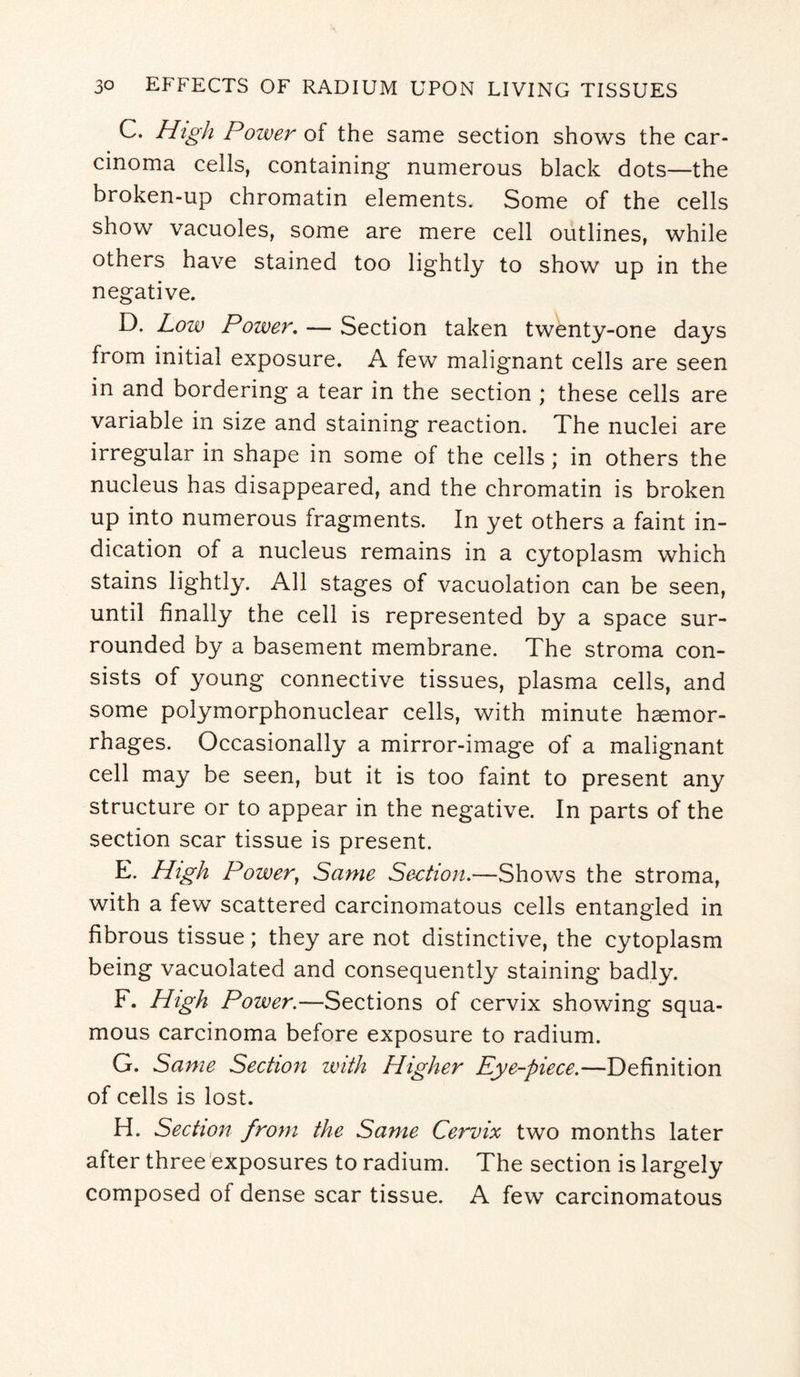 C. High Power of the same section shows the car¬ cinoma cells, containing numerous black dots—the broken-up chromatin elements. Some of the cells show vacuoles, some are mere cell outlines, while others have stained too lightly to show up in the negative. D. Low Power. — Section taken twenty-one days from initial exposure. A few malignant cells are seen in and bordering a tear in the section ; these cells are variable in size and staining reaction. The nuclei are irregular in shape in some of the cells ; in others the nucleus has disappeared, and the chromatin is broken up into numerous fragments. In yet others a faint in¬ dication of a nucleus remains in a cytoplasm which stains lightly. All stages of vacuolation can be seen, until finally the cell is represented by a space sur¬ rounded by a basement membrane. The stroma con¬ sists of young connective tissues, plasma cells, and some polymorphonuclear cells, with minute haemor¬ rhages. Occasionally a mirror-image of a malignant cell may be seen, but it is too faint to present any structure or to appear in the negative. In parts of the section scar tissue is present. E. High Power, Same Section.—Shows the stroma, with a few scattered carcinomatous cells entangled in fibrous tissue; they are not distinctive, the cytoplasm being vacuolated and consequently staining badly. F. High Power.—Sections of cervix showing squa¬ mous carcinoma before exposure to radium. G. Same Section with Higher Eye-piece.—Definition of cells is lost. H. Section from the Same Cervix two months later after three exposures to radium. The section is largely composed of dense scar tissue. A few carcinomatous