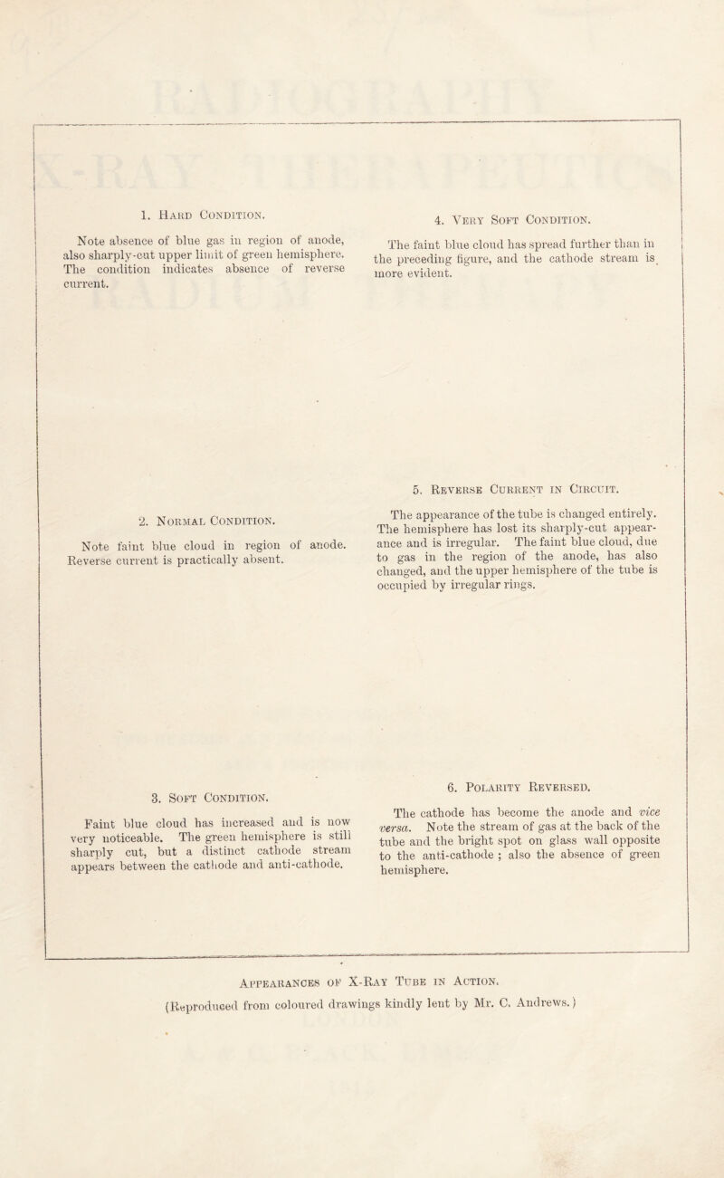 1. Hard Condition. Note absence of blue gas in region of anode, also sharply-cut upper limit of green hemisphere. The condition indicates absence of reverse current. 2. Normal Condition. Note faint blue cloud in region of anode. Reverse current is practically absent. 3. Soft Condition. Paint blue cloud has increased and is now very noticeable. The green hemisphere is still sharply cut, but a distinct cathode stream appears between the cathode and anti-cathode. 4. Very Soft Condition. The faint blue cloud has spread further than in the preceding figure, and the cathode stream is more evident. 5. Reverse Current in Circuit. The appearance of the tube is changed entirely. The hemisphere has lost its sharply-cut appear¬ ance and is irregular. The faint blue cloud, due to gas in the region of the anode, has also changed, and the upper hemisphere of the tube is occupied by irregular rings. 6. Polarity Reversed. The cathode has become the anode and vice versa. Note the stream of gas at the back of the tube and the bright spot on glass wall opposite to the anti-cathode ; also the absence of green hemisphere. Appearances of X-Ray Tube in Action. (Reproduced from coloured drawings kindly lent by Mr. C. Andrews.)