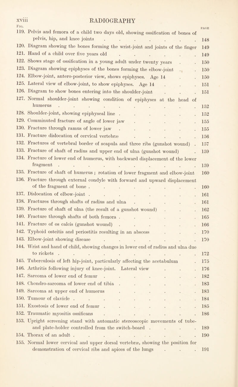 Fig. 119. Pelvis and femora of a child two days old, showing ossification of bones of pelvis, hip, and knee joints ....... 120. Diagram showing the bones forming the wrist-joint and joints of the finger 121. Hand of a child over five years old ...... 122. Shows stage of ossification in a young adult under twenty years 123. Diagram showing epiphyses of the bones forming the elbow-joint . 124. Elbow-joint, antero-posterior view, shows epiphyses. Age 14 125. Lateral view of elbow-joint, to show epiphyses. Age 14 126. Diagram to show bones entering into the shoulder-joint 127. Normal shoulder-joint showing condition of epiphyses at the head of humerus ........ 128. Shoulder-joint, showing epiphyseal line ...... 129. Comminuted fracture of angle of lower jaw ..... 130. Fracture through ramus of lower jaw ...... 131. Fracture dislocation of cervical vertebrae ..... 132. Fractures of vertebral border of scapula and three ribs (gunshot wound) . 133. Fracture of shaft of radius and upper end of ulna (gunshot wound) 134. Fracture of lower end of humerus, with backward displacement of the lower fragment .......... 135. Fracture of shaft of humerus ; rotation of lower fragment and elbow-joint 136. Fracture through external condyle with forward and upward displacement of the fragment of bone ........ 137. Dislocation of elbow-joint ........ 138. Fractures through shafts of radius and ulna ..... 139. Fracture of shaft of ulna (the result of a gunshot wround) 140. Fracture through shafts of both femora ...... 141. Fracture of os calcis (gunshot wound) ...... 142. Typhoid osteitis and periostitis resulting in an abscess 143. Elbow-joint showing disease ....... 144. Wrist and hand of child, showing changes in lower end of radius and ulna due to rickets .......... 145. Tuberculosis of left hip-joint, particularly affecting the acetabulum 146. Arthritis following injury of knee-joint. Lateral view 147. Sarcoma of lower end of femur ....... 148. Chondro-sarcoma of lower end of tibia ...... 149. Sarcoma at upper end of humerus ...... 150. Tumour of clavicle ......... 151. Exostosis of lower end of femur ....... 152. Traumatic myositis ossificans ....... 153. Upright screening stand with automatic stereoscopic movements of tube- and plate-holder controlled from the switch-board .... 154. Thorax of an adult ......... 155. Normal lower cervical and upper dorsal vertebrae, showing the position for demonstration of cervical ribs and apices of the lungs PAGE 148 149 149 150 150 150 151 151 152 152 155 155 156 157 159 159 160 160 161 161 162 165 166 170 170 172 175 176 182 183 183 184 185 186 189 190 191