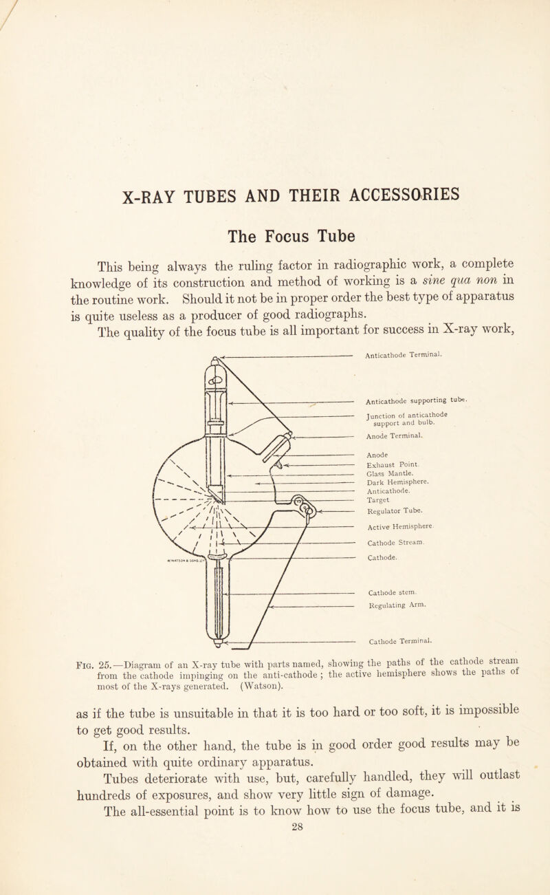 X-RAY TUBES AND THEIR ACCESSORIES The Focus Tube This being always the ruling factor in radiographic work, a complete knowledge of its construction and method of working is a sine qua non in the routine work. Should it not be in proper order the best type of apparatus is quite useless as a producer of good radiographs. The quality of the focus tube is all important for success in X-ray work, Anticathode Terminal. Anticathode supporting tube. Junction of anticathode support and bulb. Anode Terminal. Anode Exhaust Point. Glass Mantle. Dark Hemisphere. Anticathode. Target Regulator Tube. Active Hemisphere. Cathode Stream. Cathode. Cathode stem. Regulating Arm. Cathode Terminal. Fig. 25.-—Diagram of an X-ray tube with parts named, showing the paths of the cathode stream from the cathode impinging on the anti-cathode ; the active hemisphere shows the pat is o most of the X-rays generated. (Watson). as if the tube is unsuitable in that it is too bard or too soft, it is impossible to get good results. If, on the other hand, the tube is in good order good results may be obtained with quite ordinary apparatus. Tubes deteriorate with use, but, carefully handled, they will outlast hundreds of exposures, and show very little sign of damage. The all-essential point is to know how to use the focus tube, and it is