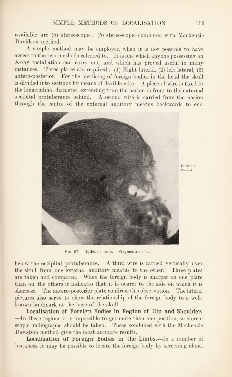 available are (a) stereoscopic ; (b) stereoscopic combined with Mackenzie Davidson method. A simple method may be employed when it is not possible to have access to the two methods referred to. It is one which anyone possessing an X-ray installation can carry out, and which has proved useful in many instances. Three plates are required : (1) Right lateral, (2) left lateral, (3) antero-posterior. For the localising of foreign bodies in the head the skull is divided into sections by means of flexible wire. A piece of wire is fixed in the longitudinal diameter, extending from the nasion in front to the external occipital protuberance behind. A second wire is carried from the nasion through the centre of the external auditory meatus backwards to end Entrance wound Fig. 97.— Bullet in brain. Fragments in face. below the occipital protuberance. A third wire is carried vertically over the skull from one external auditory meatus to the other. Three plates are taken and compared. When the foreign body is sharper on one plate than on the others it indicates that it is nearer to the side on which it is sharpest. The antero-posterior plate confirms this observation. The lateral pictures also serve to show the relationship of the foreign body to a well- known landmark at the base of the skull. Localisation of Foreign Bodies in Region of Hip and Shoulder. —In these regions it is impossible to get more than one position, so stereo¬ scopic radiographs should be taken. These combined with the Mackenzie Davidson method give the most accurate results. Localisation of Foreign Bodies in the Limbs.—In a number of instances it may be possible to locate the foreign body by screening alone.