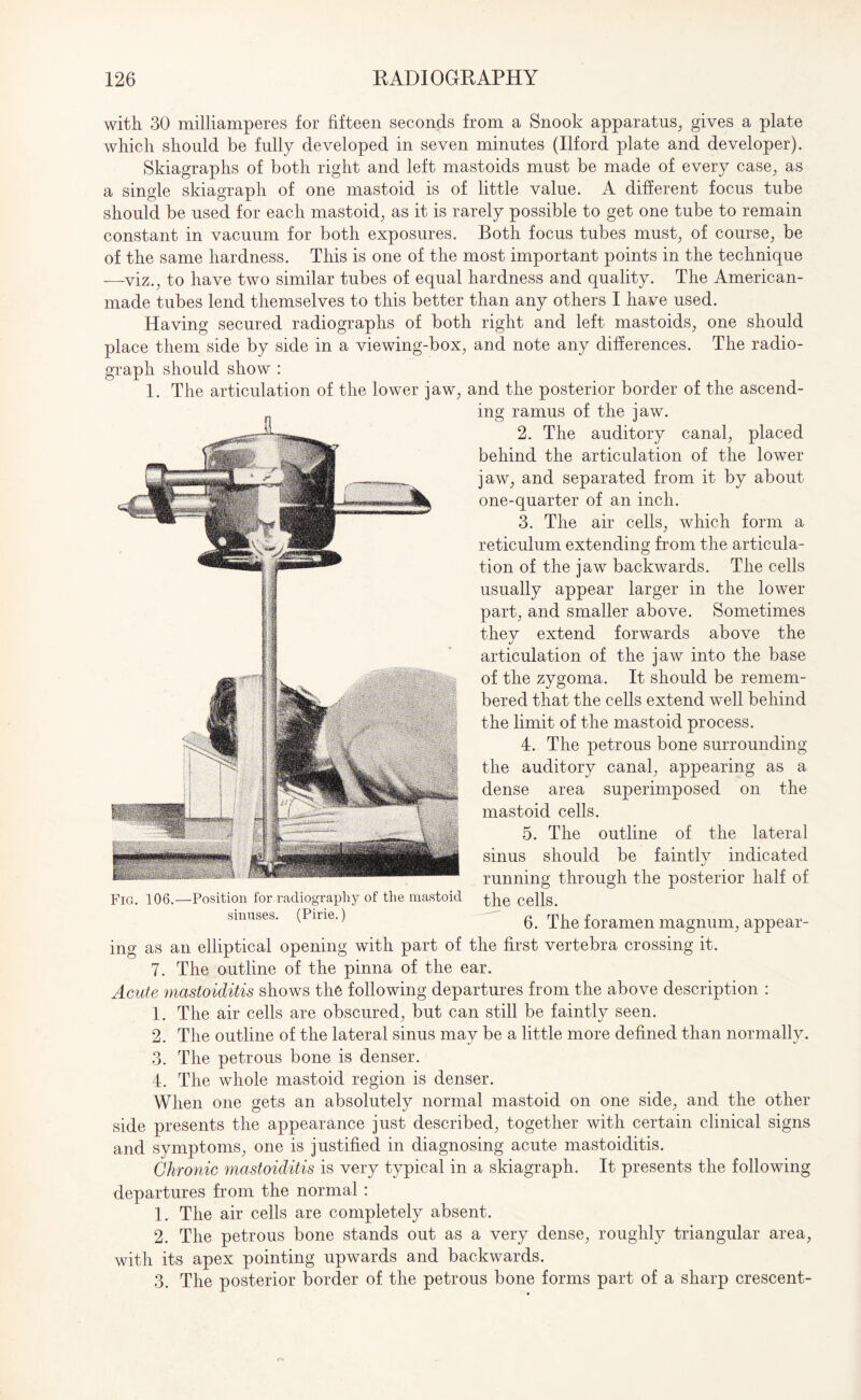 with 30 milliamperes for fifteen seconds from a Snook apparatus, gives a plate which should be fully developed in seven minutes (Ilford plate and developer). Skiagraphs of both right and left mastoids must be made of every case, as a single skiagraph of one mastoid is of little value. A different focus tube should be used for each mastoid, as it is rarely possible to get one tube to remain constant in vacuum for both exposures. Both focus tubes must, of course, be of the same hardness. This is one of the most important points in the technique —viz., to have two similar tubes of equal hardness and quality. The American- made tubes lend themselves to this better than any others I have used. Having secured radiographs of both right and left mastoids, one should place them side by side in a viewing-box, and note any differences. The radio¬ graph should show : 1. The articulation of the lower jaw, and the posterior border of the ascend¬ ing ramus of the jaw. 2. The auditory canal, placed behind the articulation of the lower jaw, and separated from it by about one-quarter of an inch. 3. The air cells, which form a reticulum extending from the articula¬ tion of the jaw backwards. The cells usually appear larger in the lower part, and smaller above. Sometimes they extend forwards above the articulation of the jaw into the base of the zygoma. It should be remem¬ bered that the cells extend well behind the limit of the mastoid process. 4. The petrous bone surrounding the auditory canal, appearing as a dense area superimposed on the mastoid cells. 5. The outline of the lateral sinus should be faintly indicated running through the posterior half of the cells. 6. The foramen magnum, appear¬ ing as an elliptical opening with part of the first vertebra crossing it. 7. The outline of the pinna of the ear. Acute mastoiditis shows the following departures from the above description : 1. The air cells are obscured, but can still be faintly seen. 2. The outline of the lateral sinus may be a little more defined than normally. 3. The petrous bone is denser. 4. The whole mastoid region is denser. When one gets an absolutely normal mastoid on one side, and the other side presents the appearance just described, together with certain clinical signs and symptoms, one is justified in diagnosing acute mastoiditis. Chronic mastoiditis is very typical in a skiagraph. It presents the following departures from the normal: 1. The air cells are completely absent. 2. The petrous bone stands out as a very dense, roughly triangular area, with its apex pointing upwards and backwards. 3. The posterior border of the petrous bone forms part of a sharp crescent- Fig. 106.—Position for radiography of the mastoid sinuses. (Pirie.)