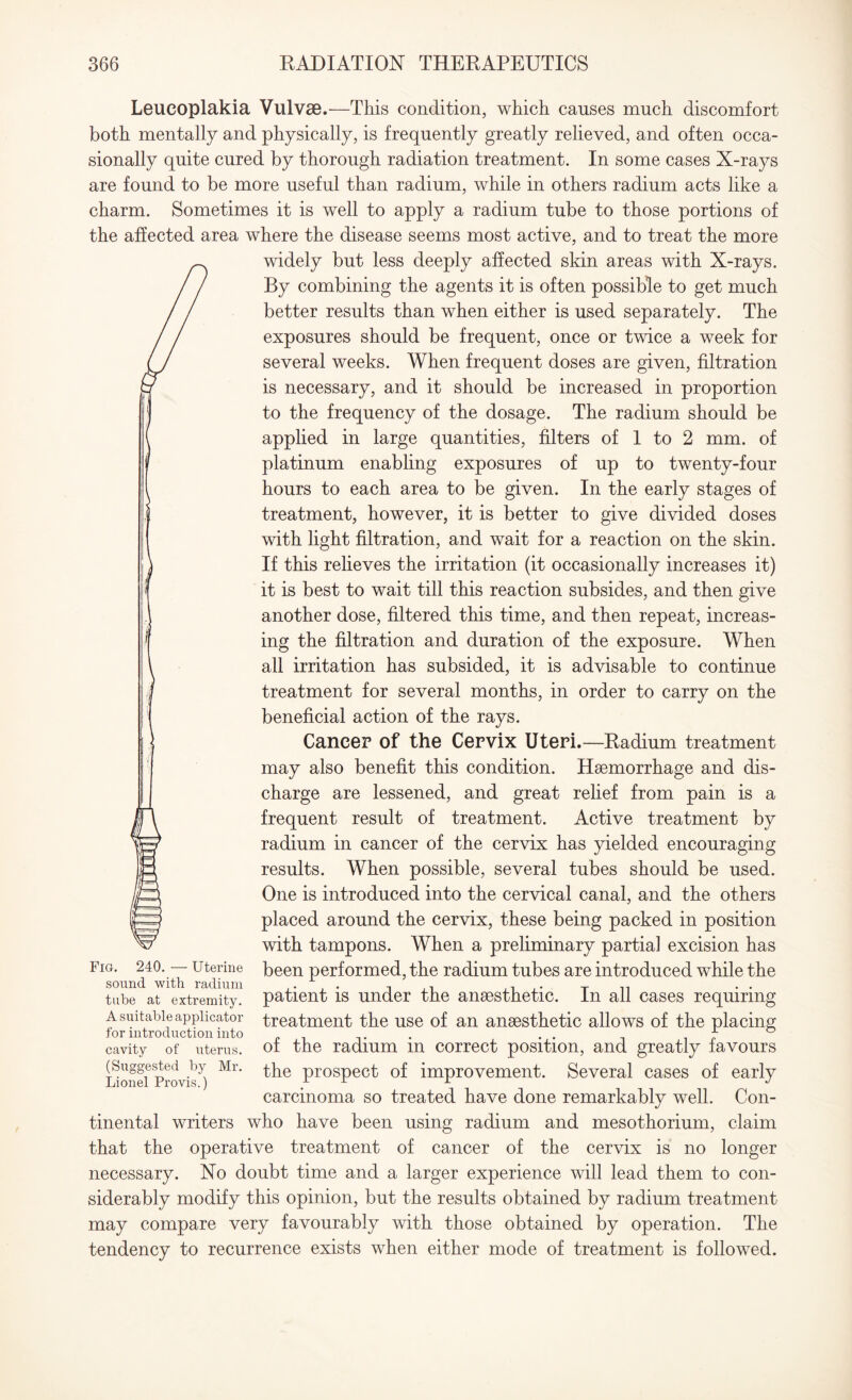 Leucoplakia Vulvse.—This condition, which causes much discomfort both mentally and physically, is frequently greatly relieved, and often occa¬ sionally quite cured by thorough radiation treatment. In some cases X-rays are found to be more useful than radium, while in others radium acts like a charm. Sometimes it is well to apply a radium tube to those portions of the affected area where the disease seems most active, and to treat the more widely but less deeply affected skin areas with X-rays. By combining the agents it is often possible to get much better results than when either is used separately. The exposures should be frequent, once or twice a week for several weeks. When frequent doses are given, filtration is necessary, and it should be increased in proportion to the frequency of the dosage. The radium should be applied in large quantities, filters of 1 to 2 mm. of platinum enabling exposures of up to twenty-four hours to each area to be given. In the early stages of treatment, however, it is better to give divided doses with light filtration, and wait for a reaction on the skin. If this relieves the irritation (it occasionally increases it) it is best to wait till this reaction subsides, and then give another dose, filtered this time, and then repeat, increas¬ ing the filtration and duration of the exposure. When all irritation has subsided, it is advisable to continue treatment for several months, in order to carry on the beneficial action of the rays. Cancer of the Cervix Uteri.—Radium treatment may also benefit this condition. Haemorrhage and dis¬ charge are lessened, and great relief from pain is a frequent result of treatment. Active treatment by radium in cancer of the cervix has yielded encouraging results. When possible, several tubes should be used. One is introduced into the cervical canal, and the others placed around the cervix, these being packed in position with tampons. When a preliminary partial excision has been performed, the radium tubes are introduced while the patient is under the anaesthetic. In all cases requiring treatment the use of an anaesthetic allows of the placing of the radium in correct position, and greatly favours the prospect of improvement. Several cases of early carcinoma so treated have done remarkably well. Con¬ tinental writers who have been using radium and mesothorium, claim that the operative treatment of cancer of the cervix is no longer necessary. No doubt time and a larger experience will lead them to con¬ siderably modify this opinion, but the results obtained by radium treatment may compare very favourably with those obtained by operation. The tendency to recurrence exists when either mode of treatment is followed. Fig. 240. — Uterine sound with radium tube at extremity. A suitable applicator for introduction into cavity of uterus. (Suggested by Mr. Lionel Provis.)