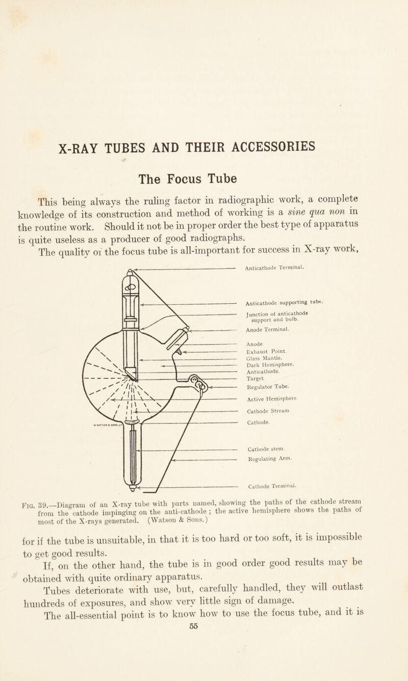 X-RAY TUBES AND THEIR ACCESSORIES The Focus Tube This being always the ruling factor in radiographic work, a complete knowledge of its construction and method of working is a sine qua non m the routine work. Should it not be in proper order the best type of apparatus is quite useless as a producer of good radiographs. The quality or the focus tube is all-important for success in X-ray work, Anticathode Terminal. Anticathode supporting tube. Junction of anticathode support and bulb. Anode Terminal. Anode Exhaust Point. Glass Mantle. Dark Hemisphere. Anticathode. Target Regulator Tube. Active Hemisphere Cathode Stream. Cathode. Cathode stem. Regulating Arm. Cathode Terminal. Fig. 39.—Diagram of an X-ray tube with parts named, showing the paths of the cathode stream from the cathode impinging on the anti-cathode ; the active hemisphere shows the paths of most of the X-rays generated. (Watson & Sons.) for if tbe tube is unsuitable, in that it is too hard or too soft, it is impossible to get good results. If, on the other hand, the tube is in good order good results may be obtained with quite ordinary apparatus. Tubes deteriorate with use, but, carefully handled, they will outlast hundreds of exposures, and show very little sign of damage. The all-essential point is to know how to use the focus tube, and it is