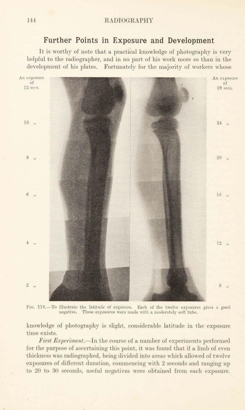 Further Points in Exposure and Development It is worthy of note that a practical knowledge of photography is very helpful to the radiographer, and in no part of his work more so than in the development of his plates. Fortunately for the majority of workers whose Fig. 118.—To illustrate the latitude of exposure. Each of the twelve exposures gives a good negative. These exposures were made with a moderately soft tube. knowledge of photography is slight, considerable latitude in the exposure time exists. First Experiment.—In the course of a number of experiments performed for the purpose of ascertaining this point, it was found that if a limb of even thickness was radiographed, being divided into areas which allowed of twelve exposures of different duration, commencing with 2 seconds and ranging up to 20 to 30 seconds, useful negatives were obtained from each exposure.