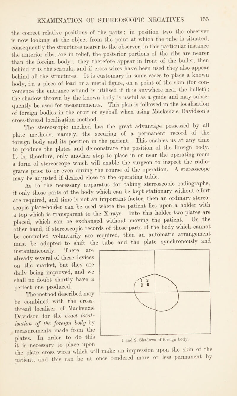 the correct relative positions of the parts ; in position two the observer is now looking at the object from the point at which the tube is situated, consequently the structures nearer to the observer, in this particular instance the anterior ribs, are in relief, the posterior portions of the ribs are nearer than the foreign body ; they therefore appear in front of the bullet, then behind it is the scapula, and if cross wires have been used they also appear behind all the structures. It is customary in some cases to place a known body, i.e. a piece of lead or a metal figure, on a point of the skin (for con¬ venience the entrance wound is utilised if it is anywhere near the bullet) ; the shadow thrown by the known body is useful as a guide and may subse¬ quently be used for measurements. This plan is followed in the localisation of foreign bodies in the orbit or eyeball when using Mackenzie Davidson’s cross-thread localisation method. The stereoscopic method has the great advantage possessed by all plate methods, namely, the securing of a permanent record of the foreign body and its position in the patient. This enables us at any time to produce the plates and demonstrate the position of the foreign body. It is, therefore, only another step to place in or near the operating-room a form of stereoscope which will enable the surgeon to inspect the radio¬ grams prior to or even during the course of the operation. A stereoscope may be adjusted if desired close to the operating table. As to the necessary apparatus for taking stereoscopic radiographs, if only those parts of the body which can be kept stationary without effort are required, and time is not an important factor, then an ordinary steieo scopic plate-holder can be used where the patient lies upon a holder with a top which is transparent to the X-rays. Into this holder two plates are placed, which can be exchanged without moving the patient. On the other hand, if stereoscopic records of those parts of the body which cannot be controlled voluntarily are required, then an automatic arrangement must be adopted to shift the tube and the plate synchronously and instantaneously. There are already several of these devices on the market, but they are daily being improved, and we shall no doubt shortly have a perfect one produced. The method described may be combined with the cross¬ thread localiser of Mackenzie Davidson for the exact local¬ isation of the foreign body by measurements made from the plates. In order to do this it is necessary to place upon the plate cross wires which will make an impression upon the skm o t e patient, and this can be at once rendered more or less permanent by Xl 2 / M 1 and 2, Shadows of foreign body.