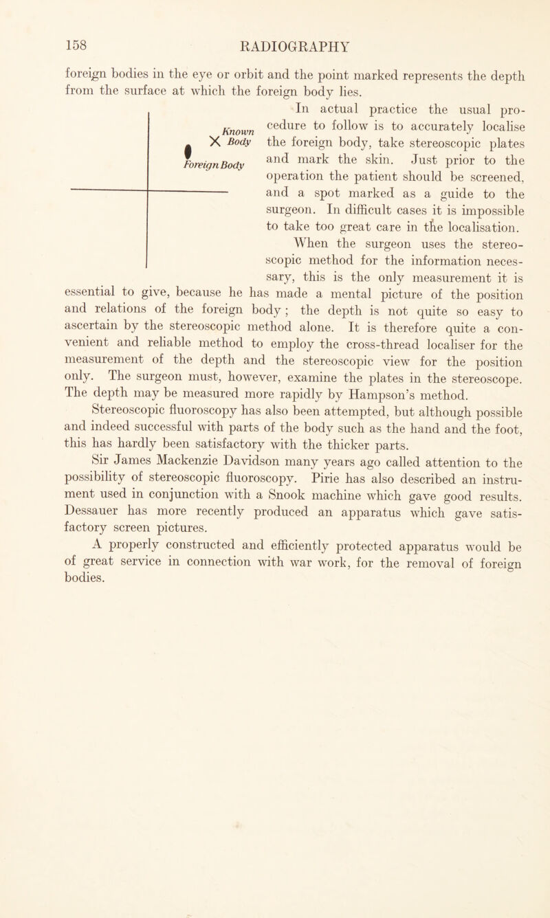 foreign bodies in the eye or orbit and the point marked represents the depth from the surface at which the foreign body lies. In actual practice the usual pro- Known ce(^ure to follow is to accurately localise X Body the foreign body, take stereoscopic plates ForvignBody anct mark the skin. Just prior to the operation the patient should be screened, ~ ~ and a spot marked as a guide to the surgeon. In difficult cases it is impossible to take too great care in tfie localisation. When the surgeon uses the stereo¬ scopic method for the information neces¬ sary, this is the only measurement it is essential to give, because he has made a mental picture of the position and relations of the foreign body ; the depth is not quite so easy to ascertain by the stereoscopic method alone. It is therefore quite a con¬ venient and reliable method to employ the cross-thread localiser for the measurement of the depth and the stereoscopic view for the position only. The surgeon must, however, examine the plates in the stereoscope. The depth may be measured more rapidly by Hampson’s method. Stereoscopic fluoroscopy has also been attempted, but although possible and indeed successful with parts of the body such as the hand and the foot, this has hardly been satisfactory with the thicker parts. Sir James Mackenzie Davidson many years ago called attention to the possibility of stereoscopic fluoroscopy. Pirie has also described an instru¬ ment used in conjunction with a Snook machine which gave good results. Dessauer has more recently produced an apparatus which gave satis¬ factory screen pictures. A properly constructed and efficiently protected apparatus would be of great service in connection with war work, for the removal of foreign bodies.