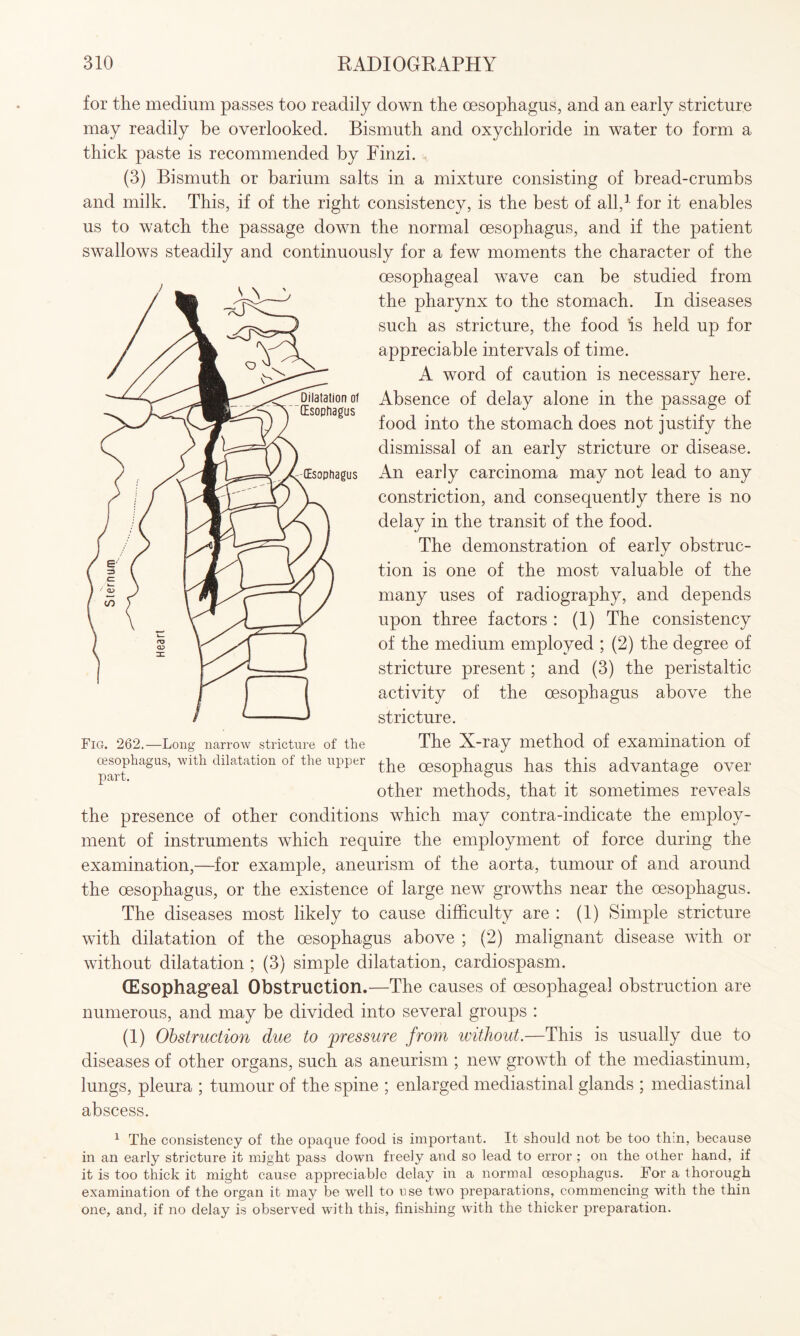 for the medium passes too readily down the oesophagus, and an early stricture may readily be overlooked. Bismuth and oxychloride in water to form a thick paste is recommended by Finzi. (3) Bismuth or barium salts in a mixture consisting of bread-crumbs and milk. This, if of the right consistency, is the best of all,1 for it enables us to watch the passage down the normal oesophagus, and if the patient swallows steadily and continuously for a few moments the character of the oesophageal wave can be studied from the pharynx to the stomach. In diseases such as stricture, the food Is held up for appreciable intervals of time. A word of caution is necessary here. Absence of delay alone in the passage of food into the stomach does not justify the dismissal of an early stricture or disease. An early carcinoma may not lead to any constriction, and consequently there is no delay in the transit of the food. The demonstration of early obstruc¬ tion is one of the most valuable of the many uses of radiography, and depends upon three factors : (1) The consistency of the medium employed ; (2) the degree of stricture present; and (3) the peristaltic activity of the oesophagus above the stricture. The X-ray method of examination of the oesophagus has this advantage over other methods, that it sometimes reveals the presence of other conditions which may contra-indicate the employ¬ ment of instruments which require the employment of force during the examination,—for example, aneurism of the aorta, tumour of and around the oesophagus, or the existence of large new growths near the oesophagus. The diseases most likely to cause difficulty are : (1) Simple stricture with dilatation of the oesophagus above ; (2) malignant disease with or without dilatation; (3) simple dilatation, cardiospasm. (Esophageal Obstruction.—The causes of oesophageal obstruction are numerous, and may be divided into several groups : (1) Obstruction due to pressure from without.—This is usually due to diseases of other organs, such as aneurism ; new growth of the mediastinum, lungs, pleura ; tumour of the spine ; enlarged mediastinal glands ; mediastinal abscess. oesophagus, with dilatation of the upper part. 1 The consistency of the opaque food is important. It should not be too thin, because in an early stricture it might pass down freely and so lead to error ; on the other hand, if it is too thick it might cause appreciable delay in a normal oesophagus. For a thorough examination of the organ it may be well to use two preparations, commencing with the thin one, and, if no delay is observed with this, finishing with the thicker preparation.