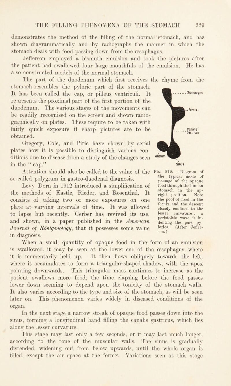 (Esophagus — Fornix Canalis Gastricus Antrum Sinus demonstrates the method of the filling of the normal stomach, and has shown diagrammatically and by radiographs the manner in which the stomach deals with food passing down from the oesophagus. Jefferson employed a bismuth emulsion and took the pictures after the patient had swallowed four large mouthfuls of the emulsion. He has also constructed models of the normal stomach. The part of the duodenum which first receives the chyme from the stomach resembles the pyloric part of the stomach. It has been called the cap, or pilleus ventriculi. It represents the proximal part of the first portion of the duodenum. The various stages of the movements can be readily recognised on the screen and shown radio¬ graphically on plates. These require to be taken with fairly quick exposure if sharp pictures are to be obtained. Gregory, Cole, and Pirie have shown by serial plates how it is possible to distinguish various con¬ ditions due to disease from a study of the changes seen in the “ cap.” Attention should also be called to the value of the Fig. 279. — Diagram of so-called polygram in gastroduodenal diagnosis. Levy Dorn in 1912 introduced a simplification of the methods of Kastle, Rieder, and Rosenthal. It consists of taking two or more exposures on one plate at varying intervals of time. It was allowed to lapse but recently. Gerber has revived its use, and shown, in a paper published in the American Journal of Rontgenology, that it possesses some value in diagnosis. When a small quantity of opaque food in the form of an emulsion is swallowed, it may be seen at the lower end of the oesophagus, where it is momentarily held up. It then flows obliquely towards the left, where it accumulates to form a triangular-shaped shadow, with the apex pointing downwards. This triangular mass continues to increase as the patient swallows more food, the time elapsing before the food passes lower down seeming to depend upon the tonicity of the stomach walls. It also varies according to the type and size of the stomach, as will be seen later on. This phenomenon varies widely in diseased conditions of the organ. In the next stage a narrow streak of opaque food passes down into the sinus, forming a longitudinal band filling the canalis gastricus, which lies along the lesser curvature. This stage may last only a few seconds, or it may last much longer, according to the tone of the muscular walls. The sinus is gradually distended, widening out from below upwards, until the whole organ is filled, except the air space at the fornix. Variations seen at this stage food through the human stomach in the up¬ right position. Note the pool of food in the fornix and the descent closely confined to the lesser curvature ; a peristaltic wave is in¬ denting the pars py- lorica. (After Jeffer¬ son.)