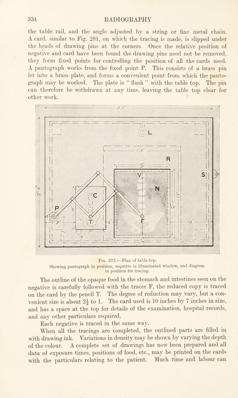 the table rail, and the angle adjusted by a string or fine metal chain. A card, similar to Fig. 281, on which the tracing is made, is slipped under the heads of drawing pins at the corners. Once the relative position of negative and card have been found the drawing pins need not be removed, they form fixed points for controlling the position of all the cards used. A pantograph works from the fixed point P. This consists of a brass pin let into a brass plate, and forms a convenient point from which the panto¬ graph may be worked. The plate is “ flush 55 with the table top. The pin can therefore be withdrawn at any time, leaving the table top clear for other work. Fig. 283.—Plan of table-top. Showing pantograph in position, negative in illuminated window, and diagram in position for tracing. The outline of the opaque food in the stomach and intestines seen on the negative is carefully followed with the tracer F, the reduced copy is traced on the card by the pencil T. The degree of reduction may vary, but a con¬ venient size is about 2J to 1. The card used is 10 inches by 7 inches in size, and has a space at the top for details of the examination, hospital records, and any other particulars required. Each negative is traced in the same way. When all the tracings are completed, the outlined parts are filled in with drawing ink. Variations in density may be shown by varying the depth of the colour. A complete set of drawings has now been prepared and all data of exposure times, positions of food, etc., may be printed on the cards with the particulars relating to the patient. Much time and labour can