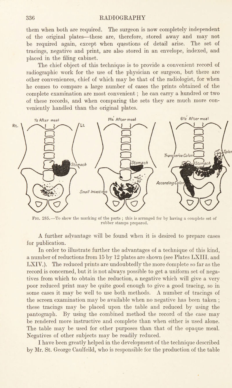 them when both are required. The surgeon is now completely independent of the original plates—these are, therefore, stored away and may not be required again, except when questions of detail arise. The set of tracings, negative and print, are also stored in an envelope, indexed, and placed in the filing cabinet. The chief object of this technique is to provide a convenient record of radiographic work for the use of the physician or surgeon, but there are other conveniences, chief of which may be that of the radiologist, for when he comes to compare a large number of cases the prints obtained of the complete examination are most convenient; he can carry a hundred or two of these records, and when comparing the sets they are much more con¬ veniently handled than the original plates. Fig. 285.—To show the marking of the parts ; this is arranged for by having a complete set of rubber stamps prepared. A further advantage will be found when it is desired to prepare cases for publication. In order to illustrate further the advantages of a technique of this kind, a number of reductions from 15 by 12 plates are shown (see Plates LXIII. and LXIV.). The reduced prints are undoubtedly the more complete so far as the record is concerned, but it is not always possible to get a uniform set of nega¬ tives from which to obtain the reduction, a negative which will give a very poor reduced print may be quite good enough to give a good tracing, so in some cases it may be well to use both methods. A number of tracings of the screen examination may be available when no negative has been taken ; these tracings may be placed upon the table and reduced by using the pantograph. By using the combined method the record of the case may be rendered more instructive and complete than when either is used alone. The table may be used for other purposes than that of the opaque meal. Negatives of other subjects may be readily reduced. I have been greatly helped in the development of the technique described by Mr. St. George Caulfeild, who is responsible for the production of the table