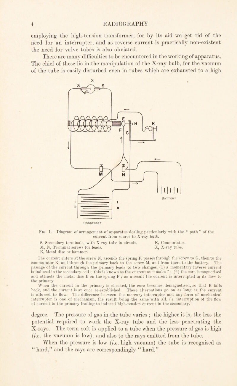 employing the high-tension transformer, for by its aid we get rid of the need for an interrupter, and as reverse current is practically non-existent the need for valve tubes is also obviated. There are many difficulties to be encountered in the working of apparatus. The chief of these lie in the manipulation of the X-ray bulb, for the vacuum of the tube is easily disturbed even in tubes which are exhausted to a high Fig. 1.—Diagram of arrangement of apparatus dealing particularly with the “ path ” of the current from source to X-ray bulb. S, Secondary terminals, with X-ray tube in circuit. K, Commutator. M, N, Terminal screws for leads. X, X-ray tube. E, Metal disc or hammer. The current enters at the screw N, ascends the spring F, passes through the screw to G, then to the commutator K, and through the primary back to the screw M, and from there to the battery. The passage of the current through the primary leads to two changes, (1) a momentary inverse current is induced in the secondary coil ; this is known as the current at “ make ” ; (2) the core is magnetised and attracts the metal disc E on the spring F ; as a result the current is interrupted in its flow to the primary. When the current in the primary is checked, the core becomes demagnetised, so that E falls back, and the current is at once re-established. These alternations go on as long as the current is allowed to flow. The difference between the mercury interrupter and any form of mechanical interrupter is one of mechanism, the result being the same with all, i.e. interruption of the how of current in the primary leading to induced high-tension current in the secondary. degree. The pressure of gas in the tube varies ; the higher it is, the less the potential required to work the X-ray tube and the less penetrating the X-rays. The term soft is applied to a tube when the pressure of gas is high (i.e. the vacuum is low), and also to the rays emitted from the tube. When the pressure is low (i.e. high vacuum) the tube is recognised as “ hard,” and the rays are correspondingly “ hard.”