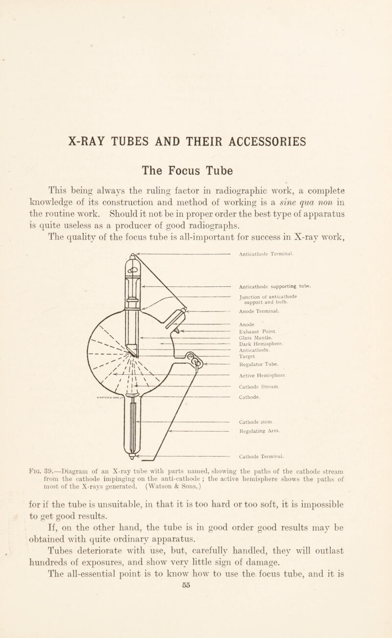 X-RAY TUBES AND THEIR ACCESSORIES The Focus Tube This being always the ruling factor in radiographic work, a complete knowledge of its construction and method of working is a sine qua non in the routine work. Should it not be in proper order the best type of apparatus is quite useless as a producer of good radiographs. The quality of the focus tube is all-important for success in X-ray work, Anticathode Terminal. Anticathode supporting tube. Junction of anticathode support and bulb. Anode Terminal. Anode Exhaust Point. Glass Mantle. Dark Hemisphere. Anticathode. Target Regulator Tube. Active Hemisphere. Cathode Stream. Cathode. Cathode stem. Regulating Arm. Cathode Terminal. Fig. 39.—Diagram of an X-ray tube with parts named, showing the paths of the cathode stream from the cathode impinging on the anti-cathode ; the active hemisphere shows the paths of most of the X-rays generated. (Watson & Sons.) for if the tube is unsuitable, in that it is too hard or too soft, it is impossible to get good results. If, on the other hand, the tube is in good order good results may be obtained with quite ordinary apparatus. Tubes deteriorate with use, but, carefully handled, they will outlast hundreds of exposures, and show very little sign of damage. The all-essential point is to know how to use the focus tube, and it is