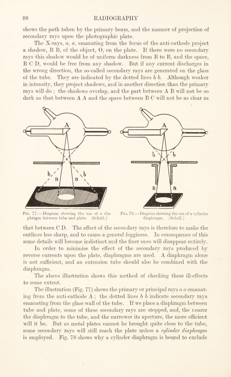 shows the path taken by the primary beam, and the manner of projection of secondary rays upon the photographic plate. The X-rays, a, a, emanating from the focus of the anti-cathode project a shadow, B B, of the object, 0, on the plate. If there were no secondary rays this shadow would be of uniform darkness from B to B, and the space, B C D, would be free from any shadow. But if any current discharges in the wrong direction, the so-called secondary rays are generated on the glass of the tube. They are indicated by the dotted lines b b. Although weaker in intensity, they project shadows, and in another direction than the primary rays will do ; the shadows overlap, and the part between A B will not be so dark as that between A A and the space between B C will not be as clear as Fig. 77.—Diagram showing the use of a dia¬ phragm between tube and plate. (Schall.) Fig. 78.- - Diagram showing the use of a cylinder diaphragm. (Schall.) that between C D. The effect of the secondary rays is therefore to make the outlines less sharp, and to cause a general fogginess. In consequence of this some details will become indistinct and the finer ones will disappear entirely. In order to minimise the effect of the secondary rays produced by reverse currents upon the plate, diaphragms are used. A diaphragm alone is not sufficient, and an extension tube should also be combined with the diaphragm. The above illustration shows this method of checking these ill-effects to some extent. The illustration (Fig. 77) shows the primary or principal rays a a emanat¬ ing from the anti-cathode A ; the dotted lines b b indicate secondary rays emanating from the glass wall of the tube. If we place a diaphragm between tube and plate, some of these secondary rays are stopped, and, the nearer the diaphragm to the tube, and the narrower its aperture, the more efficient will it be. But as metal plates cannot be brought quite close to the tube, some secondary rays will still reach the plate unless a cylinder diaphragm is employed. Fig. 78 shows why a cylinder diaphragm is bound to exclude
