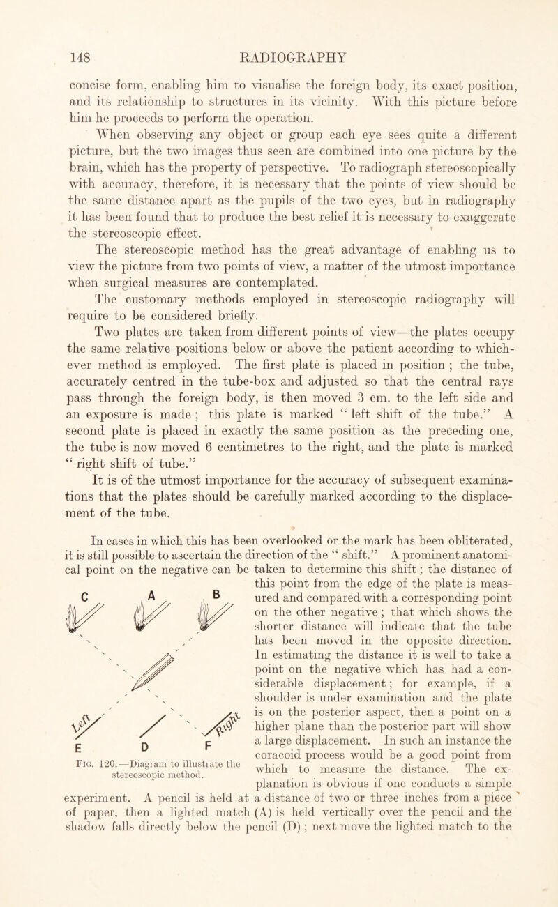 concise form, enabling him to visualise the foreign body, its exact position, and its relationship to structures in its vicinity. With this picture before him he proceeds to perform the operation. When observing any object or group each eye sees quite a different picture, but the two images thus seen are combined into one picture by the brain, which has the property of perspective. To radiograph stereoscopically with accuracy, therefore, it is necessary that the points of view should be the same distance apart as the pupils of the two eyes, but in radiography it has been found that to produce the best relief it is necessary to exaggerate the stereoscopic effect. The stereoscopic method has the great advantage of enabling us to view the picture from two points of view, a matter of the utmost importance when surgical measures are contemplated. The customary methods employed in stereoscopic radiography will require to be considered briefly. Two plates are taken from different points of view—the plates occupy the same relative positions below or above the patient according to which¬ ever method is employed. The first plate is placed in position ; the tube, accurately centred in the tube-box and adjusted so that the central rays pass through the foreign body, is then moved 3 cm. to the left side and an exposure is made ; this plate is marked “ left shift of the tube.” A second plate is placed in exactly the same position as the preceding one, the tube is now moved 6 centimetres to the right, and the plate is marked “ right shift of tube.” It is of the utmost importance for the accuracy of subsequent examina¬ tions that the plates should be carefully marked according to the displace¬ ment of the tube. In cases in which this has been overlooked or the mark has been obliterated, it is still possible to ascertain the direction of the “ shift.” A prominent anatomi¬ cal point on the negative can be taken to determine this shift; the distance of this point from the edge of the plate is meas¬ ured and compared with a corresponding point on the other negative ; that which shows the shorter distance will indicate that the tube has been moved in the opposite direction. In estimating the distance it is well to take a point on the negative which has had a con¬ siderable displacement; for example, if a shoulder is under examination and the plate is on the posterior aspect, then a point on a higher plane than the posterior part will show a large displacement. In such an instance the coracoid process would be a good point from which to measure the distance. The ex¬ planation is obvious if one conducts a simple experiment. A pencil is held at a distance of two or three inches from a piece  of paper, then a lighted match (A) is held vertically over the pencil and the shadow falls directly below the pencil (D); next move the lighted match to the V E A V w A V D Fig. 120.—Diagram to illustrate the stereoscopic method.