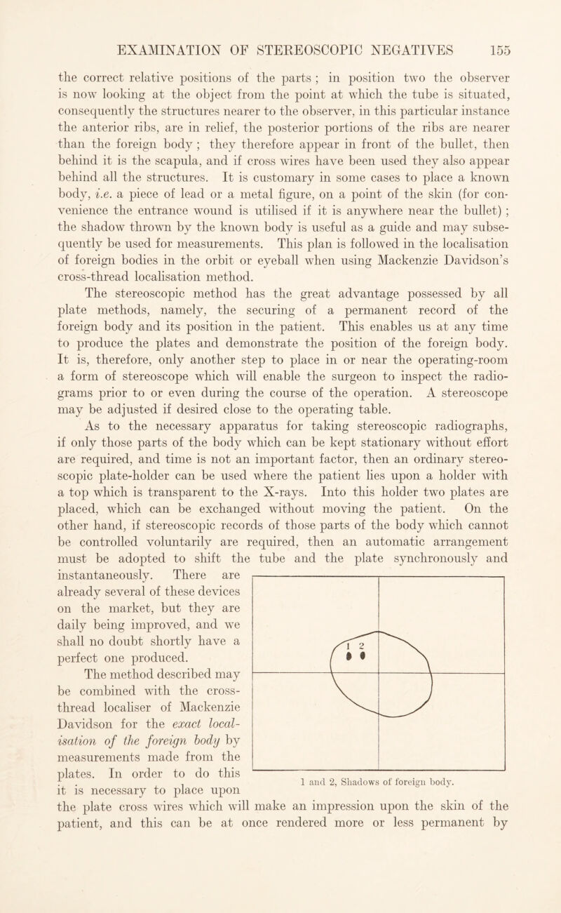the correct relative positions of the parts ; in position two the observer is now looking at the object from the point at which the tube is situated, consequently the structures nearer to the observer, in this particular instance the anterior ribs, are in relief, the posterior portions of the ribs are nearer than the foreign body ; they therefore appear in front of the bullet, then behind it is the scapula, and if cross wires have been used they also appear behind all the structures. It is customary in some cases to place a known body, i.e. a piece of lead or a metal figure, on a point of the skin (for con¬ venience the entrance wound is utilised if it is anywhere near the bullet) ; the shadow thrown by the known body is useful as a guide and may subse¬ quently be used for measurements. This plan is followed in the localisation of foreign bodies in the orbit or eyeball when using Mackenzie Davidson’s cross-thread localisation method. The stereoscopic method has the great advantage possessed by all plate methods, namely, the securing of a permanent record of the foreign body and its position in the patient. This enables us at any time to produce the plates and demonstrate the position of the foreign body. It is, therefore, only another step to place in or near the operating-room a form of stereoscope which will enable the surgeon to inspect the radio¬ grams prior to or even during the course of the operation. A stereoscope may be adjusted if desired close to the operating table. As to the necessary apparatus for taking stereoscopic radiographs, if only those parts of the body which can be kept stationary without effort are required, and time is not an important factor, then an ordinary stereo¬ scopic plate-holder can be used where the patient lies upon a holder with a top which is transparent to the X-rays. Into this holder two plates are placed, which can be exchanged without moving the patient. On the other hand, if stereoscopic records of those parts of the body which cannot be controlled voluntarily are required, then an automatic arrangement must be adopted to shift the tube and the plate synchronously and instantaneously. There are already several of these devices on the market, but they are daily being improved, and we shall no doubt shortly have a perfect one produced. The method described may be combined with the cross¬ thread localiser of Mackenzie Davidson for the exact local¬ isation of the foreign body by measurements made from the plates. In order to do this it is necessary to place upon the plate cross wires which will make an impression upon the skin of the patient, and this can be at once rendered more or less permanent by