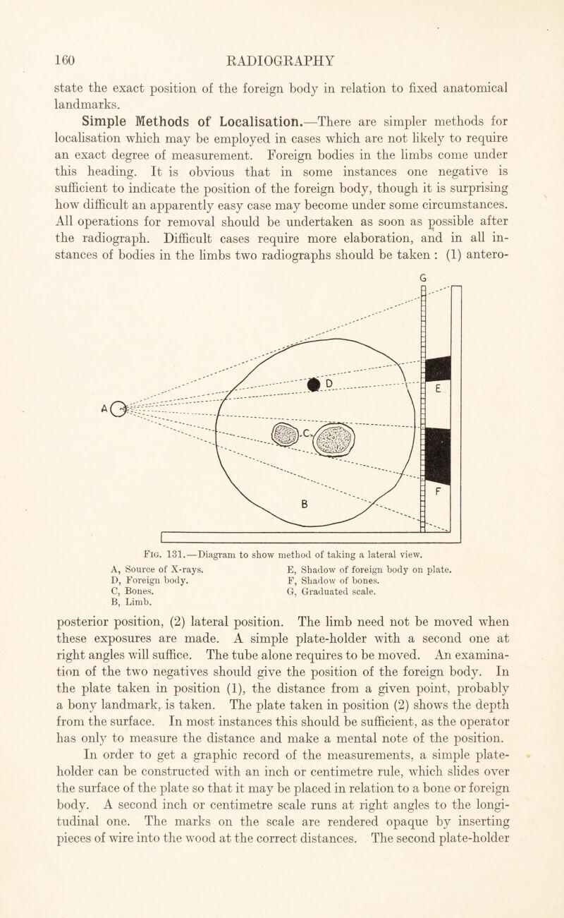 state the exact position of the foreign body in relation to fixed anatomical landmarks. Simple Methods of Localisation.—There are simpler methods for localisation which may be employed in cases which are not likely to require an exact degree of measurement. Foreign bodies in the limbs come under this heading. It is obvious that in some instances one negative is sufficient to indicate the position of the foreign body, though it is surprising how difficult an apparently easy case may become under some circumstances. All operations for removal should be undertaken as soon as possible after the radiograph. Difficult cases require more elaboration, and in all in¬ stances of bodies in the limbs two radiographs should be taken : (1) antero- G Fig. 131.—Diagram to show method of taking a lateral view. A, Source of X-rays. E, Shadow of foreign body on plate. D, Foreign body. F, Shadow of bones. C, Bones. G, Graduated scale. B, Limb. posterior position, (2) lateral position. The limb need not be moved when these exposures are made. A simple plate-holder with a second one at right angles will suffice. The tube alone requires to be moved. An examina¬ tion of the two negatives should give the position of the foreign body. In the plate taken in position (1), the distance from a given point, probably a bony landmark,- is taken. The plate taken in position (2) shows the depth from the surface. In most instances this should be sufficient, as the operator lias only to measure the distance and make a mental note of the position. In order to get a graphic record of the measurements, a simple plate- holder can be constructed with an inch or centimetre rule, which slides over the surface of the plate so that it may be placed in relation to a bone or foreign body. A second inch or centimetre scale runs at right angles to the longi¬ tudinal one. The marks on the scale are rendered opaque by inserting pieces of wire into the wood at the correct distances. The second plate-holder