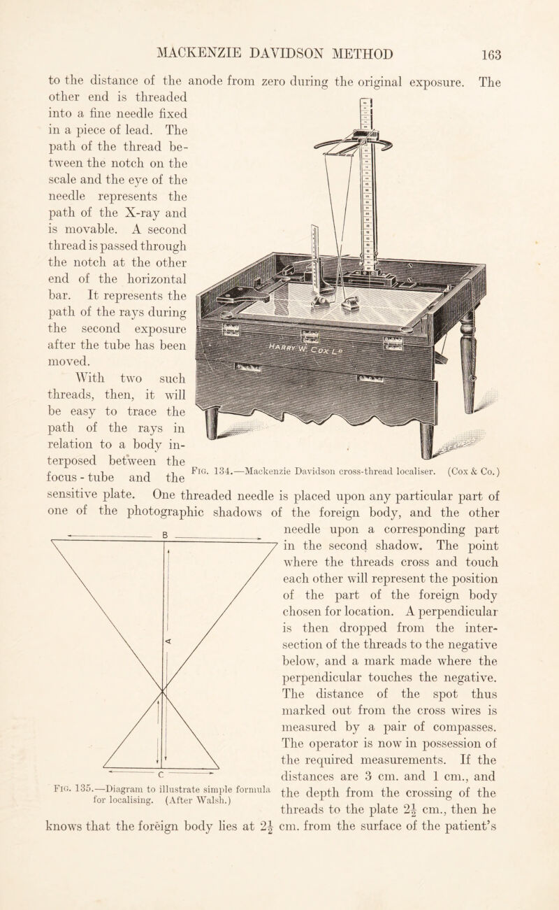 to the distance of the anode from zero during the original exposure. The other end is threaded into a fine needle fixed in a piece of lead. The path of the thread be¬ tween the notch on the scale and the eye of the needle represents the path of the X-ray and is movable. A second thread is passed through the notch at the other end of the horizontal bar. It represents the path of the rays during the second exposure after the tube has been moved. With two such threads, then, it will be easy to trace the path of the rays in relation to a body in¬ terposed between the focus - tube and the sensitive plate. One threaded needle is placed upon any particular part of one of the photographic shadows of the foreign body, and the other needle upon a corresponding part in the second shadow. The point where the threads cross and touch each other will represent the position of the part of the foreign body chosen for location. A perpendicular is then dropped from the inter¬ section of the threads to the negative below, and a mark made where the perpendicular touches the negative. The distance of the spot thus marked out from the cross wires is measured by a pair of compasses. The operator is now in possession of the required measurements. If the distances are 3 cm. and 1 cm., and r ig. 13d.- Diagram to illustrate simple formula ^he qepth from the crossing of the ior localising. (After Walsh.) r ° threads to the plate 2J cm., then he knows that the foreign body lies at 2J cm. from the surface of the patient’s