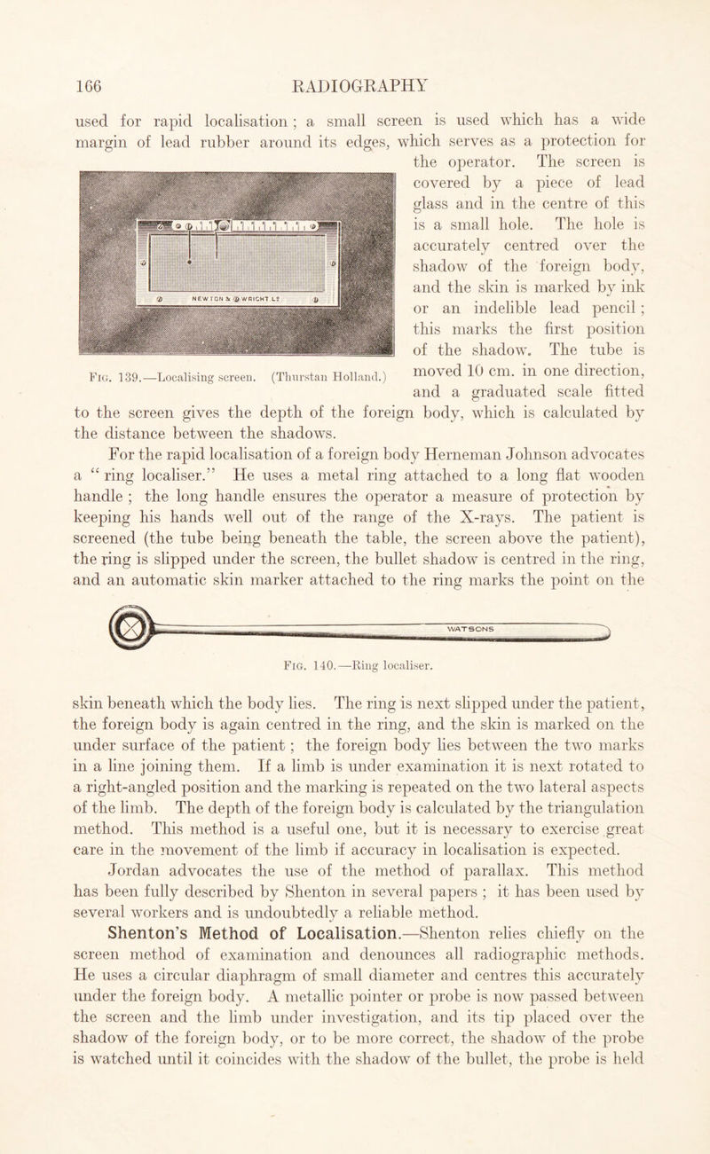 used for rapid localisation; a small screen is used which has a wide margin of lead rubber around its edges, which serves as a protection for the operator. The screen is covered by a piece of lead glass and in the centre of this is a small hole. The hole is accuratelv centred over the «/ shadow of the foreign body, and the skin is marked by ink or an indelible lead pencil ; this marks the first position of the shadow. The tube is moved 10 cm. in one direction, and a graduated scale fitted to the screen gives the depth of the foreign body, which is calculated by the distance between the shadows. For the rapid localisation of a foreign body Herneman Johnson advocates a “ ring localiser.” He uses a metal ring attached to a long flat wooden handle ; the long handle ensures the operator a measure of protection by keeping his hands well out of the range of the X-rays. The patient is screened (the tube being beneath the table, the screen above the patient), the ring is slipped under the screen, the bullet shadow is centred in the ring, and an automatic skin marker attached to the ring marks the point on the WATSONS Fig. 139.—Localising screen. (Thnrstan Holland.) Fig. 140.—Ring localiser. skin beneath which the body lies. The ring is next slipped under the patient , the foreign body is again centred in the ring, and the skin is marked on the under surface of the patient; the foreign body lies between the two marks in a line joining them. If a limb is under examination it is next rotated to a right-angled position and the marking is repeated on the two lateral aspects of the limb. The depth of the foreign body is calculated by the triangulation method. This method is a useful one, but it is necessary to exercise great care in the movement of the limb if accuracy in localisation is expected. Jordan advocates the use of the method of parallax. This method has been fully described by Shenton in several papers ; it has been used by several workers and is undoubtedly a reliable method. Shenton’s Method of Localisation.—Shenton relies chiefly on the screen method of examination and denounces all radiographic methods. He uses a circular diaphragm of small diameter and centres this accurately under the foreign body. A metallic pointer or probe is now passed between the screen and the limb under investigation, and its tip placed over the shadow of the foreign body, or to be more correct, the shadow of the probe is watched until it coincides with the shadow of the bullet, the probe is held