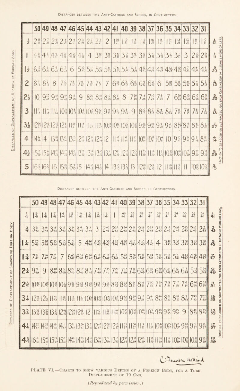 Distances of Displacement of Shadow of Foreign Body. Distances between the Anti-Cathode and Screen, in Centimeters. > Q O £3 z o u a: u. O £ o Q < X LO u, o r LU £ u: o < p. Q u, o VP U4 o z < H W Q 50 49 48 47 46 45 44 43 42 41 40 39 38 37 36 35 34 33 32 31 k 21 21 2h 21 21 21 21, 21 2 1 21 11 11 11 18 18 11 18 18 13 13 I 4n 4?! 41 4! 44 44 4 34 31 5>8 J) II 31 31 34 31 31 31 31 3 710 L 11 21 Ik r i2 U23 6! 61 64 6 r 2 o 3 23 S- D23 51 51 51 51 51 41 41 41 41 41 44 41 41 2 8fz 84 8 71 7,4 74 7± i 12 7,4 7 64 64 64 64 6,1 6 5'i 54 54 54 51 2k 10 9S 91 91 91 9 020 025 8S OIO 025 81 8 720 / 25 Til / 25 71° / 25 71 1 61 63 63 61 3 114 lls 114 108 104 104 101 O 13 94 94 94 9 Q 10 O 13 84 84 84 7ii / 13 74 74 n 3s 129 I2» 13 121 IIP 111 IUP 111 101 ion 108 101 98 91 91 91 Q 72 02? 81 81 82? 4 144 14 13 S 131 13s 121 12,1 121 12 111 Ilfs 111 101 104 101 10 911 94 94 O 12 O 14 42 151 151 141 141 141 131 131 131 131 121 121 124 III IIS 111 101 104 101 91 91 5 168 161 16 151 154 15 14 § 14,4 14 138 134 13 . 121 124 12 114 III II 101 10,4 1 21 JL II 3 23 ft A A 13 _2L 27 4- R- 9 29 Distances betwefn the Anti-Cathode and Screen, in Centimeters. 50 49 48 47 46 45 44 43 42 41 40 39 38 37 30 35 34 33 32 31 l 14 II II II II II II II II 1 40 41 39 4-1 38 41 37 4T 36 41 35 4T 34 41 33 4T 32 41 31 41 3 •4- 7 21 J43 9 18 043 31 V- vj 43 31 31 3i 3 940 £.43 21 935; <_43 9 31 L 43 928 2.43 925 2.43 9 22 2.43 9 19 C43 9 16 L 43 Oil 443 910 £_ 43 21 li r 25 J45 U20 J45 51 5£ 51 5 4S 4M /m T”45 441 44J A^ 9-45 41 41 4 O 40 3 45 D45 0 30 045 31 920 D45 li 721 / 47 73 73 7 6$ 6£ 69 r 19 U47 C 12 047 6,3 53 U38 047 53 58 51 51 51 44! 4?, 4,1 2i 94 9 040 049 Q 31 049 0 22 049 O 13 049 81 744 / 49 7,1 726 / 49 73 7- / 49 61 61 £30 049 61 61 6,1 51 51 24 101 101 10s 101 911 91 91 91 91 81 81 0 21 Osi 81 750 / 51 739 / 51 71 71 71 6 61 34 128 121 IIS 111 111 III, Id 101 101 101 98 91 QiZ 2/ 53 91 Q44 L753 8b 81 81 71 78 3i 131 131 131 121 121 121 12 111 III ll£ 101 nos 101 101 91 Q30 7 55 98 9 8® 81 44 IASI Ft 57 141 i4-~ 1157 141 1357 131 131 I2S 121 121 III II3-6 1157 IIS 111 101 101 101 91! 98 91 44 — 161 I5S 151 151 141 141 141 131 131 131 121 1?- 1 U59 12,1 IIS 11,1 111 101 101 101 Q5i C/59 JL 41 43 5 45 ~7 47 9 49 n 51 13 53 J5 55 17 57 19 59 PLATE VI.—Charts to show various Depths of a Foreign Body, for a Tube Displacement of 10 Cms. [Reproduced by permission.) Fraction to be added or subtracted for each Centimeter of distance moreor less, Fraction to be added or subtracted for each Centimeter of distance more or less.