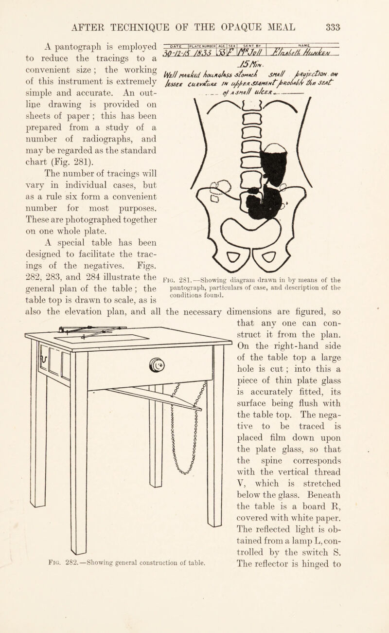 PATE PLATE NUMBER AGE SEX SENT BY Fig. 281.-—Showing diagram drawn in by means of the pantograph, particulars of case, and description of the conditions found. A pantograph is employed I £3™ to reduce the tracings to a J5M convenient size; the working W/ ol this instrument is extremely jESSE« cuRv/tuxs /» u/>/>ex />*oMA tie simple and accurate. An out- -tfAsm// uJcex. line drawing is provided on sheets of paper ; this has been prepared from a study of a number of radiographs, and may be regarded as the standard chart (Fig. 281). The number of tracings will vary in individual cases, but as a rule six form a convenient number for most purposes. These are photographed together on one whole plate. A special table has been designed to facilitate the trac¬ ings of the negatives. Figs. 282, 283, and 284 illustrate the general plan of the table ; the table top is drawn to scale, as is also the elevation plan, and all the necessary dimensions are figured, so that anv one can con¬ struct it from the plan. On the right-hand side of the table top a large hole is cut; into this a piece of thin plate glass is accurately fitted, its surface being flush with the table top. The nega¬ tive to be traced is placed film down upon the plate glass, so that the spine corresponds with the vertical thread V, which is stretched below the glass. Beneath the table is a board R, covered with white paper. The reflected light is ob¬ tained from a lamp L, con¬ trolled by the switch S. The reflector is hinged to Fig. 282.—Showing general construction of table.