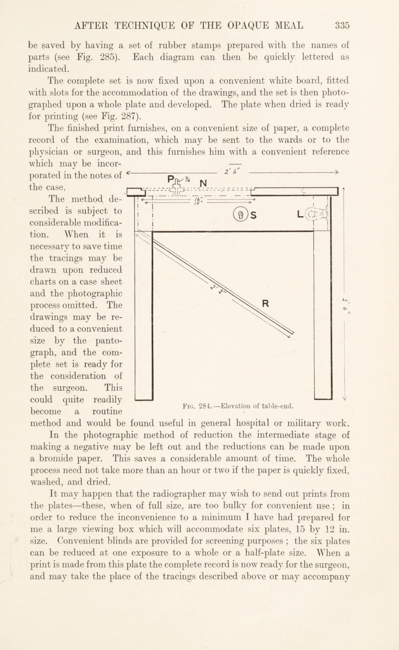 be saved by having a set of rubber stamps prepared with the names of parts (see Fig. 285). Each diagram can then be quickly lettered as indicated. The complete set is now fixed upon a convenient white board, fitted with slots for the accommodation of the drawings, and the set is then photo¬ graphed upon a whole plate and developed. The plate when dried is ready for printing (see Fig. 287). The finished print furnishes, on a convenient size of paper, a complete record of the examination, which may be sent to the wards or to the physician or surgeon, and this furnishes him with a convenient reference which mav be incor- — * „ I ,  - 2 ^ -> 2i: ft % N :r /s 3 porated in the notes of ^ the case. p The method de¬ scribed is subject to considerable modifica¬ tion. When it is necessary to save time the tracings may be drawn upon reduced charts on a case sheet and the photographic process omitted. The drawings may be re¬ duced to a convenient size by the panto¬ graph, and the com¬ plete set is ready for the consideration of the surgeon. This could quite readily become a routine method and would be found useful in general hospital or military work. In the photographic method of reduction the intermediate stage of making a negative may be left out and the reductions can be made upon a bromide paper. This saves a considerable amount of time. The whole process need not take more than an hour or two if the paper is quickly fixed, washed, and dried. It may happen that the radiographer may wish to send out prints from the plates—these, when of full size, are too bulky for convenient use ; in order to reduce the inconvenience to a minimum I have had prepared for me a large viewing box which will accommodate six plates, 15 by 12 in. size. Convenient blinds are provided for screening purposes ; the six plates can be reduced at one exposure to a whole or a half-plate size. When a print is made from this plate the complete record is now ready for the surgeon, and may take the place of the tracings described above or may accompany v Fig. 284.—Elevation of table-end.