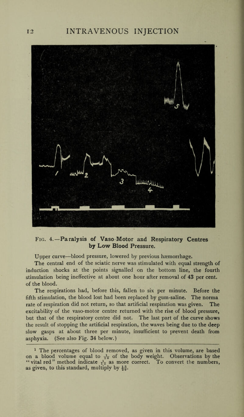 Fig. 4.—Paralysis of Vaso Motor and Respiratory Centres by Low Blood Pressure. Upper curve—blood pressure, lowered by previous haemorrhage. The central end of the sciatic nerve was stimulated with equal strength of induction shocks at the points signalled on the bottom line, the fourth stimulation being ineffective at about one hour after removal of 43 per cent, of the blood. The respirations had, before this, fallen to six per minute. Before the fifth stimulation, the blood lost had been replaced by gum-saline. The norma rate of respiration did not return, so that artificial respiration was given. The excitability of the vaso-motor centre returned with the rise of blood pressure, but that of the respiratory centre did not. The last part of the curve shows the result of stopping the artificial respiration, the waves being due to the deep slow gasps at about three per minute, insufficient to prevent death from asphyxia. (See also Fig. 34 below.) 1 The percentages of blood removed, as given in this volume, are based on a blood volume equal to of the body weight. Observations by the “vital red” method indicate xV as more correct. To convert the numbers, as given, to this standard, multiply by