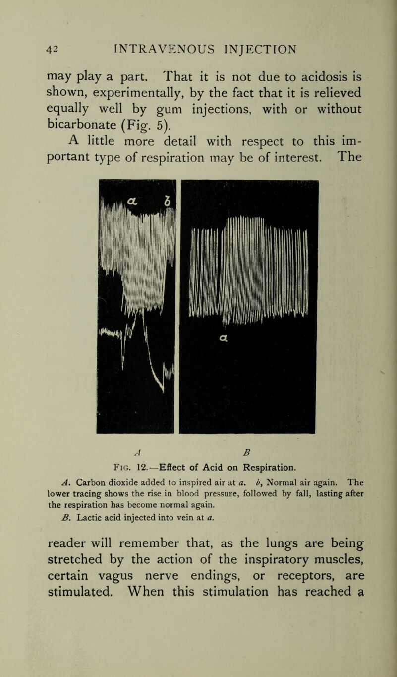 may play a part. That it is not due to acidosis is shown, experimentally, by the fact that it is relieved equally well by gum injections, with or without bicarbonate (Fig. 5). A little more detail with respect to this im¬ portant type of respiration may be of interest. The A B Fig. 12.—Effect of Acid on Respiration. A. Carbon dioxide added to inspired air at a. b, Normal air again. The lower tracing shows the rise in blood pressure, followed by fall, lasting after the respiration has become normal again. B. Lactic acid injected into vein at a. reader will remember that, as the lungs are being stretched by the action of the inspiratory muscles, certain vagus nerve endings, or receptors, are stimulated. When this stimulation has reached a