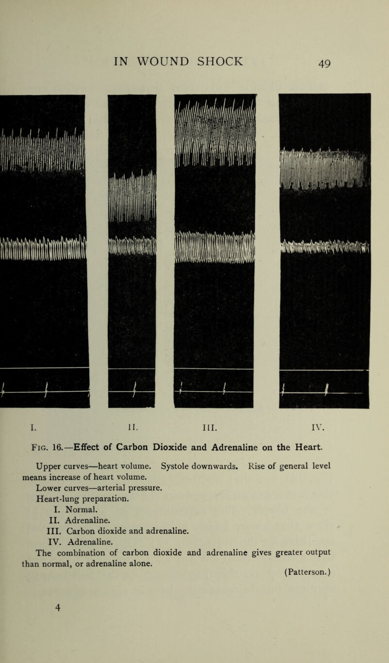 IV. Fig. 16.—Effect of Carbon Dioxide and Adrenaline on the Heart. Upper curves—heart volume. Systole downwards. Rise of general level means increase of heart volume. Lower curves—arterial pressure. Heart-lung preparation. I. Normal. II. Adrenaline. III. Carbon dioxide and adrenaline. IV. Adrenaline. The combination of carbon dioxide and adrenaline gives greater output than normal, or adrenaline alone. (Patterson.) 4