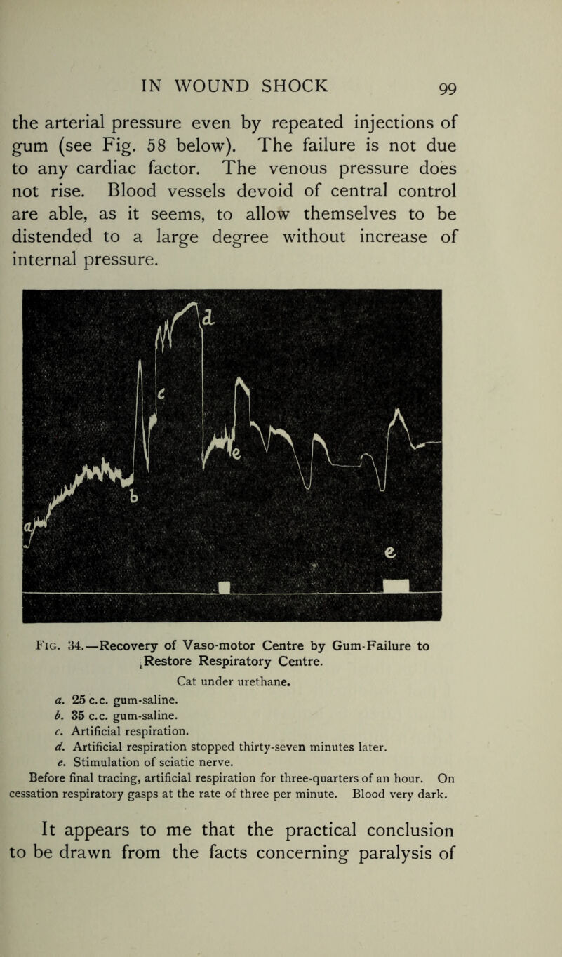 the arterial pressure even by repeated injections of gum (see Fig. 58 below). The failure is not due to any cardiac factor. The venous pressure does not rise. Blood vessels devoid of central control are able, as it seems, to allow themselves to be distended to a large degree without increase of internal pressure. Fig. 34.—Recovery of Vaso motor Centre by Gum-Failure to 'Restore Respiratory Centre. Cat under urethane. a. 25c.c. gum-saline. b. 35 c.c. gum-saline. c. Artificial respiration. d. Artificial respiration stopped thirty-seven minutes later. e. Stimulation of sciatic nerve. Before final tracing, artificial respiration for three-quarters of an hour. On cessation respiratory gasps at the rate of three per minute. Blood very dark. It appears to me that the practical conclusion to be drawn from the facts concerning paralysis of