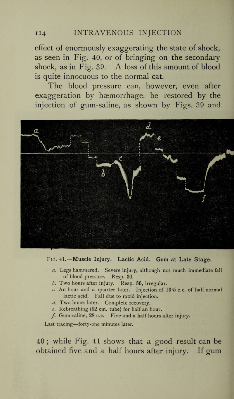 effect of enormously exaggerating the state of shock, as seen in Fig. 40, or of bringing on the secondary shock, as in Fig. 39. A loss of this amount of blood is quite innocuous to the normal cat. The blood pressure can, however, even after exaggeration by haemorrhage, be restored by the injection of gum-saline, as shown by Figs. 39 and Fig. 41.—Muscle Injury. Lactic Acid. Gum at Late Stage. a. Legs hammered. Severe injury, although not much immediate fall of blood pressure. Resp. 30. b. Two hours after injury. Resp. 56, irregular. c. An hour and a quarter later. Injection of 13‘5 c.c. of half normal lactic acid. Fall due to rapid injection. d. Two hours later. Complete recovery. e. Rebreathing (92 cm. tube) for half an hour. /. Gum-saline, 28 c.c. Five and a half hours after injury. Last tracing—forty-one minutes later. 40 ; while Fig. 41 shows that a good result can be obtained five and a half hours after injury. If gum