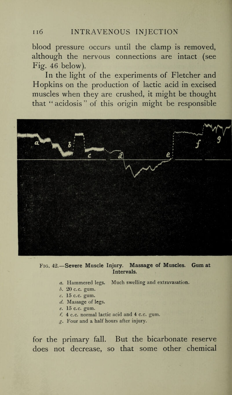 blood pressure occurs until the clamp is removed, although the nervous connections are intact (see Fig. 46 below). In the light of the experiments of Fletcher and Hopkins on the production of lactic acid in excised muscles when they are crushed, it might be thought that “acidosis” of this origin might be responsible Fig. 42.—Severe Muscle Injury. Massage of Muscles. Gum at Intervals. a. Hammered legs. Much swelling and extravasation. b. 20 c.c. gum. c. 15 c.c. gum. d. Massage of legs. e. 15 c.c. gum. f. 4 c.c. normal lactic acid and 4 c.c. gum. g. Four and a half hours after injury. for the primary fall. But the bicarbonate reserve does not decrease, so that some other chemical