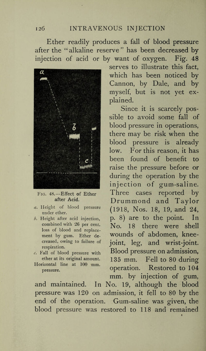 Ether readily produces a fall of blood pressure after the ‘‘alkaline reserve” has been decreased by injection of acid or by want of oxygen. Fig. 48 serves to illustrate this fact, which has been noticed by Cannon, by Dale, and by myself, but is not yet ex¬ plained. Since it is scarcely pos¬ sible to avoid some fall of blood pressure in operations, there may be risk when the blood pressure is already low. For this reason, it has been found of benefit to raise the pressure before or during the operation by the injection of gum-saline. Three cases reported by Drummond and Taylor (1918, Nos. 18, 19, and 24, p. 8) are to the point. In No. 18 there were shell wounds of abdomen, knee- joint, leg, and wrist-joint. Blood pressure on admission, 135 mm. Fell to 80 during operation. Restored to 104 mm. by injection of gum, In No. 19, although the blood pressure was 120 on admission, it fell to 80 by the end of the operation. Gum-saline was given, the blood pressure was restored to 118 and remained Fig. 48.—Effect of Ether after Acid. pressure a. Height of blood under ether. b. Height after acid injection, combined with 26 per cent, loss of blood and replace¬ ment by gum. Ether de¬ creased, owing to failure of respiration. c. Fall of blood pressure with ether at its original amount. Horizontal line at 100 mm. pressure. and maintained.