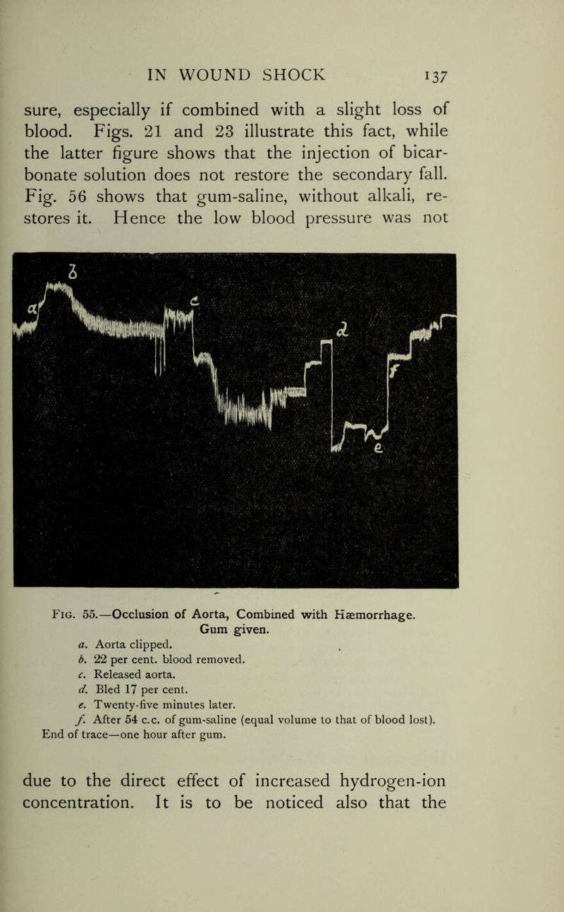 sure, especially if combined with a slight loss of blood. Figs. 21 and 23 illustrate this fact, while the latter figure shows that the injection of bicar¬ bonate solution does not restore the secondary fall. Fig. 56 shows that gum-saline, without alkali, re¬ stores it. Hence the low blood pressure was not Fig. 55.—Occlusion of Aorta, Combined with Haemorrhage. Gum given. a. Aorta clipped. b. 22 per cent, blood removed. c. Released aorta. d. Bled 17 per cent. e. Twenty-five minutes later. f. After 54 c.c. of gum-saline (equal volume to that of blood lost). End of trace—one hour after gum. due to the direct effect of increased hydrogen-ion concentration. It is to be noticed also that the