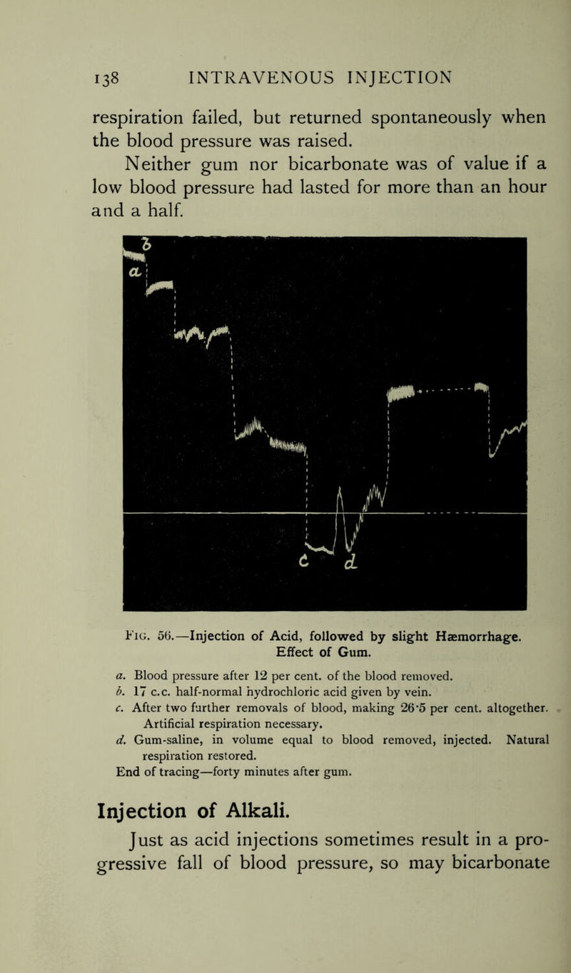 respiration failed, but returned spontaneously when the blood pressure was raised. Neither gum nor bicarbonate was of value if a low blood pressure had lasted for more than an hour and a half. Fig. 56.—Injection of Acid, followed by slight Haemorrhage. Effect of Gum. a. Blood pressure after 12 per cent, of the blood removed. b. 17 c.c. half-normal hydrochloric acid given by vein. c. After two further removals of blood, making 26'5 per cent, altogether. Artificial respiration necessary. d. Gum-saline, in volume equal to blood removed, injected. Natural respiration restored. End of tracing—forty minutes after gum. Injection of Alkali. Just as acid injections sometimes result in a pro¬ gressive fall of blood pressure, so may bicarbonate