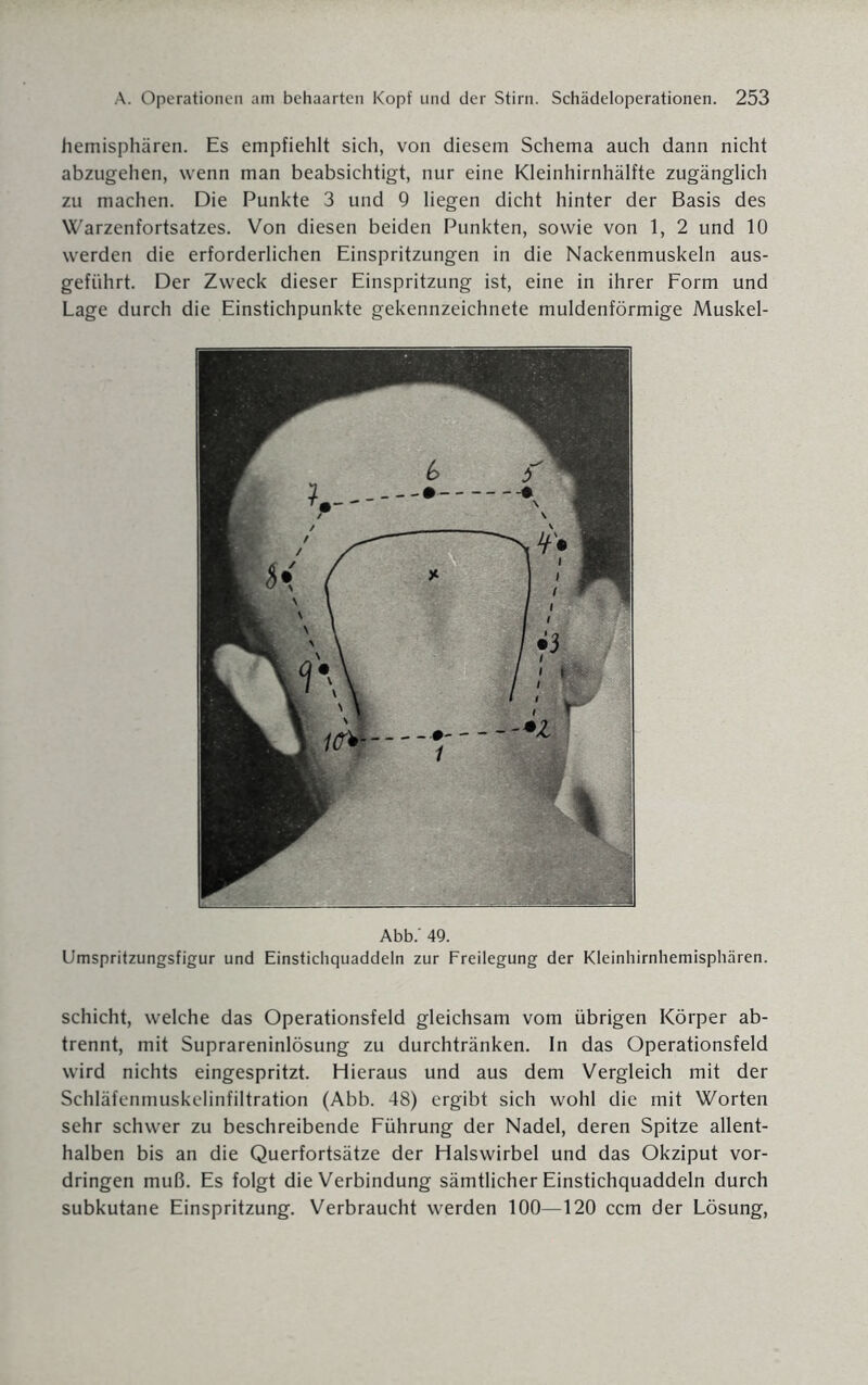 hemisphären. Es empfiehlt sich, von diesem Schema auch dann nicht abzugehen, wenn man beabsichtigt, nur eine Kleinhirnhälfte zugänglich zu machen. Die Punkte 3 und 9 liegen dicht hinter der Basis des Warzenfortsatzes. Von diesen beiden Punkten, sowie von 1, 2 und 10 werden die erforderlichen Einspritzungen in die Nackenmuskeln aus¬ geführt. Der Zweck dieser Einspritzung ist, eine in ihrer Form und Lage durch die Einstichpunkte gekennzeichnete muldenförmige Muskel- Abb.' 49. Umspritzungsfigur und Einstichquaddeln zur Freilegung der Kleinhirnhemisphären. Schicht, welche das Operationsfeld gleichsam vom übrigen Körper ab¬ trennt, mit Suprareninlösung zu durchtränken. In das Operationsfeld wird nichts eingespritzt. Hieraus und aus dem Vergleich mit der Schläfenmuskelinfiltration (Abb. 48) ergibt sich wohl die mit Worten sehr schwer zu beschreibende Führung der Nadel, deren Spitze allent¬ halben bis an die Querfortsätze der Halswirbel und das Okziput Vor¬ dringen muß. Es folgt die Verbindung sämtlicher Einstichquaddeln durch subkutane Einspritzung. Verbraucht werden 100—120 ccm der Lösung,