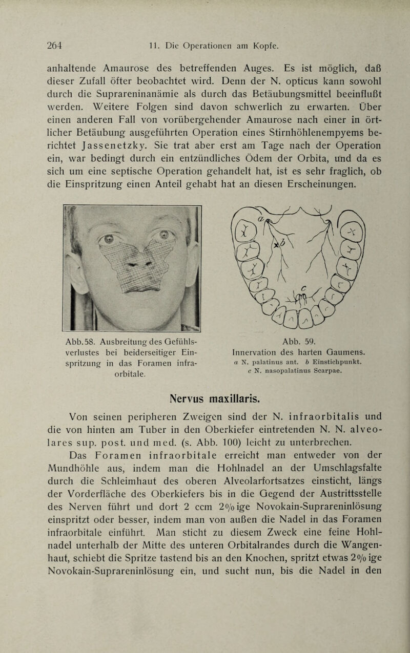anhaltende Amaurose des betreffenden Auges. Es ist möglich, daß dieser Zufall öfter beobachtet wird. Denn der N. opticus kann sowohl durch die Suprareninanämie als durch das Betäubungsmittel beeinflußt werden. Weitere Folgen sind davon schwerlich zu erwarten. Über einen anderen Fall von vorübergehender Amaurose nach einer in ört¬ licher Betäubung ausgeführten Operation eines Stirnhöhlenempyems be¬ richtet Jassenetzky. Sie trat aber erst am Tage nach der Operation ein, war bedingt durch ein entzündliches Ödem der Orbita, und da es sich um eine septische Operation gehandelt hat, ist es sehr fraglich, ob die Einspritzung einen Anteil gehabt hat an diesen Erscheinungen. Abb.58. Ausbreitung des Gefühls¬ verlustes bei beiderseitiger Ein¬ spritzung in das Foramen infra¬ orbitale. Abb. 59. Innervation des harten Gaumens. a N. palatinus ant. b Einstichpunkt, c N. nasopalatinus Scarpae. Nervus maxillaris. Von seinen peripheren Zweigen sind der N. infraorbitalis und die von hinten am Tuber in den Oberkiefer eintretenden N. N. alveo¬ lares sup. post, und med. (s. Abb. 100) leicht zu unterbrechen. Das Foramen infraorbitale erreicht man entweder von der Mundhöhle aus, indem man die Hohlnadel an der Umschlagsfalte durch die Schleimhaut des oberen Alveolarfortsatzes einsticht, längs der Vorderfläche des Oberkiefers bis in die Gegend der Austrittsstelle des Nerven führt und dort 2 ccm 2o/0ige Novokain-Suprareninlösung einspritzt oder besser, indem man von außen die Nadel in das Foramen infraorbitale einführt. Man sticht zu diesem Zweck eine feine Hohl¬ nadel unterhalb der Mitte des unteren Orbitalrandes durch die Wangen¬ haut, schiebt die Spritze tastend bis an den Knochen, spritzt etwas 2o/0 ige Novokain-Suprareninlösung ein, und sucht nun, bis die Nadel in den