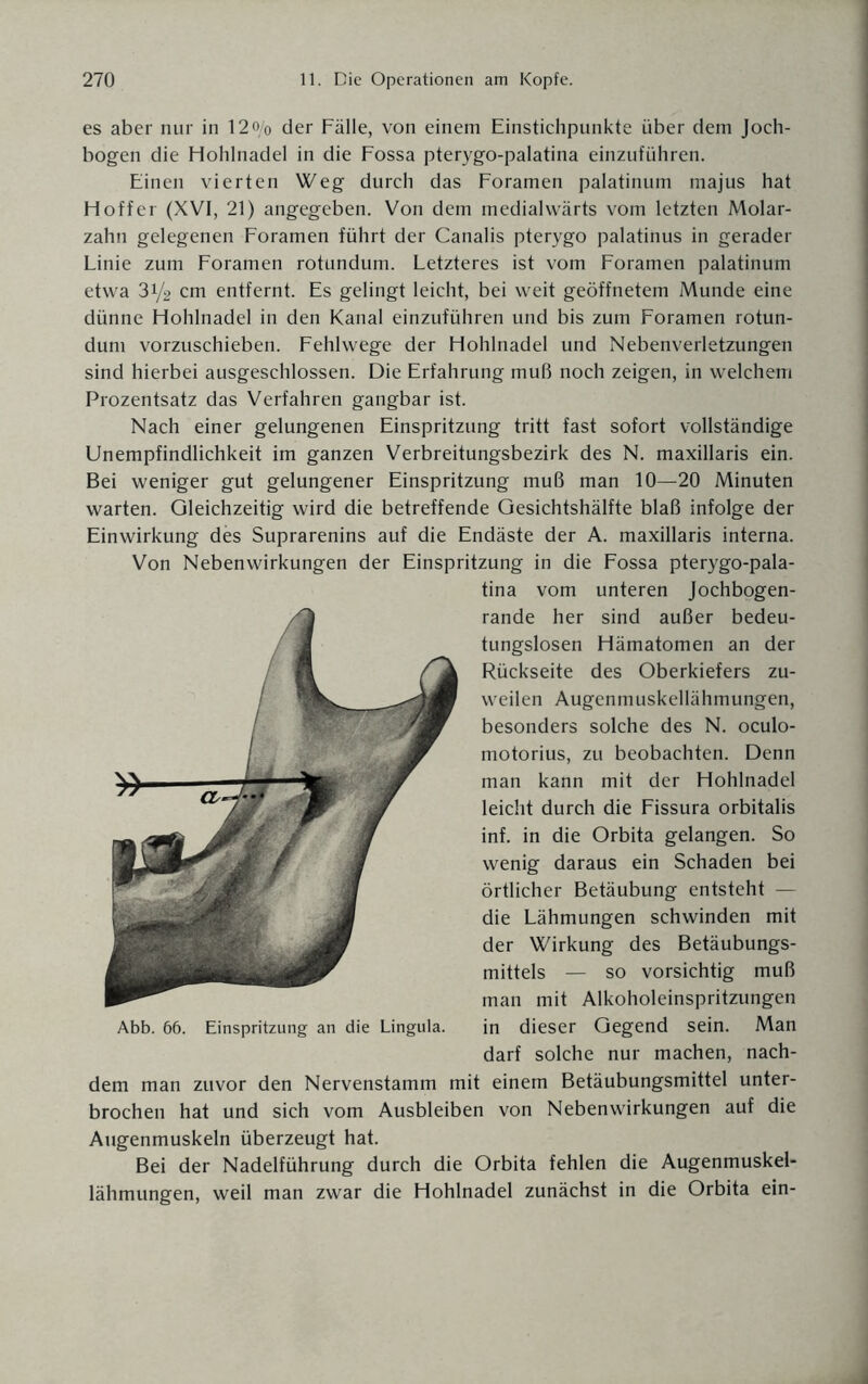 es aber nur in 12o/0 der Fälle, von einem Einstichpunkte über dem Joch¬ bogen die Hohlnadel in die Fossa pterygo-palatina einzuführen. Einen vierten Weg durch das Foramen palatinum majus hat Hoff er (XVI, 21) angegeben. Von dem medialvvärts vom letzten Molar¬ zahn gelegenen Foramen führt der Canalis pterygo palatinus in gerader Linie zum Foramen rotundum. Letzteres ist vom Foramen palatinum etwa 31/2 cm entfernt. Es gelingt leicht, bei weit geöffnetem Munde eine dünne Hohlnadel in den Kanal einzuführen und bis zum Foramen rotun¬ dum vorzuschieben. Fehlwege der Hohlnadel und Nebenverletzungen sind hierbei ausgeschlossen. Die Erfahrung muß noch zeigen, in welchem Prozentsatz das Verfahren gangbar ist. Nach einer gelungenen Einspritzung tritt fast sofort vollständige Unempfindlichkeit im ganzen Verbreitungsbezirk des N. maxillaris ein. Bei weniger gut gelungener Einspritzung muß man 10—20 Minuten warten. Gleichzeitig wird die betreffende Gesichtshälfte blaß infolge der Einwirkung des Suprarenins auf die Endäste der A. maxillaris interna. Von Nebenwirkungen der Einspritzung in die Fossa pterygo-pala¬ tina vom unteren Jochbogen¬ rande her sind außer bedeu¬ tungslosen Hämatomen an der Rückseite des Oberkiefers zu¬ weilen Augenmuskellähmungen, besonders solche des N. oculo- motorius, zu beobachten. Denn man kann mit der Hohlnadel leicht durch die Fissura orbitalis inf. in die Orbita gelangen. So wenig daraus ein Schaden bei örtlicher Betäubung entsteht — die Lähmungen schwinden mit der Wirkung des Betäubungs¬ mittels — so vorsichtig muß man mit Alkoholeinspritzungen in dieser Gegend sein. Man darf solche nur machen, nach¬ dem man zuvor den Nervenstamm mit einem Betäubungsmittel unter¬ brochen hat und sich vom Ausbleiben von Nebenwirkungen auf die Augenmuskeln überzeugt hat. Bei der Nadelführung durch die Orbita fehlen die Augenmuskel¬ lähmungen, weil man zwar die Hohlnadel zunächst in die Orbita ein- Abfa. 66. Einspritzung an die Lingula.