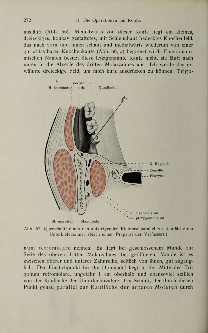 ausläuft (Abb. 66). Medialwärts von dieser Kante liegt ein kleines, dreieckiges, konkav gestaltetes, mit Schleimhaut bedecktes Knochenfeld, das nach vorn und innen schaut und medialwärts wiederum von einer gut abtastbaren Knochenkante (Abb. 66, a) begrenzt wird. Einen anato¬ mischen Namen besitzt diese letztgenannte Kante nicht, sie läuft nach unten in die Alveole des dritten Molarzahnes aus. Ich werde das er¬ wähnte dreieckige Feld, um mich kurz ausdrücken zu können, Trigo- Vestibulum M. buccinator oris Mundboden Abb. 67. Querschnitt durch den aufsteigenden Kieferast parallel zur Kaufläche der Unterkieferzähne. (Nach einem Präparat des Verfassers.) num retromolare nennen. Es liegt bei geschlossenem Munde zur Seite des oberen dritten Molarzahnes, bei geöffnetem Munde ist es zwischen oberer und unterer Zahnreihe, seitlich von ihnen, gut zugäng¬ lich. Der Einstichpunkt für die Hohlnadel liegt in der Mitte des Tri- gonum retromolare, ungefähr 1 cm oberhalb und ebensoviel seitlich von der Kaufläche der Unterkieferzähne. Ein Schnitt, der durch diesen Punkt genau parallel zur Kaufläche der unteren Molaren durch