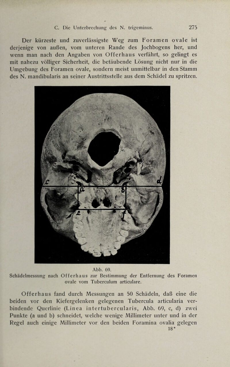 Der kürzeste und zuverlässigste Weg zum Foramen ovale ist derjenige von außen, vom unteren Rande des Jochbogens her, und wenn man nach den Angaben von Offerhaus verfährt, so gelingt es mit nahezu völliger Sicherheit, die betäubende Lösung nicht nur in die LImgebung des Foramen ovale, sondern meist unmittelbar in den Stamm des N. mandibularis an seiner Austrittsstelle aus dem Schädel zu spritzen. Abb. 69. Schädelmessung nach Offerhaus zur Bestimmung der Entfernung des Foramen ovale vom Tuberculum articulare. Offerhaus fand durch Messungen an 50 Schädeln, daß eine die beiden vor den Kiefergelenken gelegenen Tubercula articularia ver¬ bindende Querlinie (Linea intertubercularis, Abb. 69, c, d) zwei Punkte (a und b) schneidet, welche wenige Millimeter unter und in der Regel auch einige Millimeter vor den beiden Foramina ovalia gelegen 18*