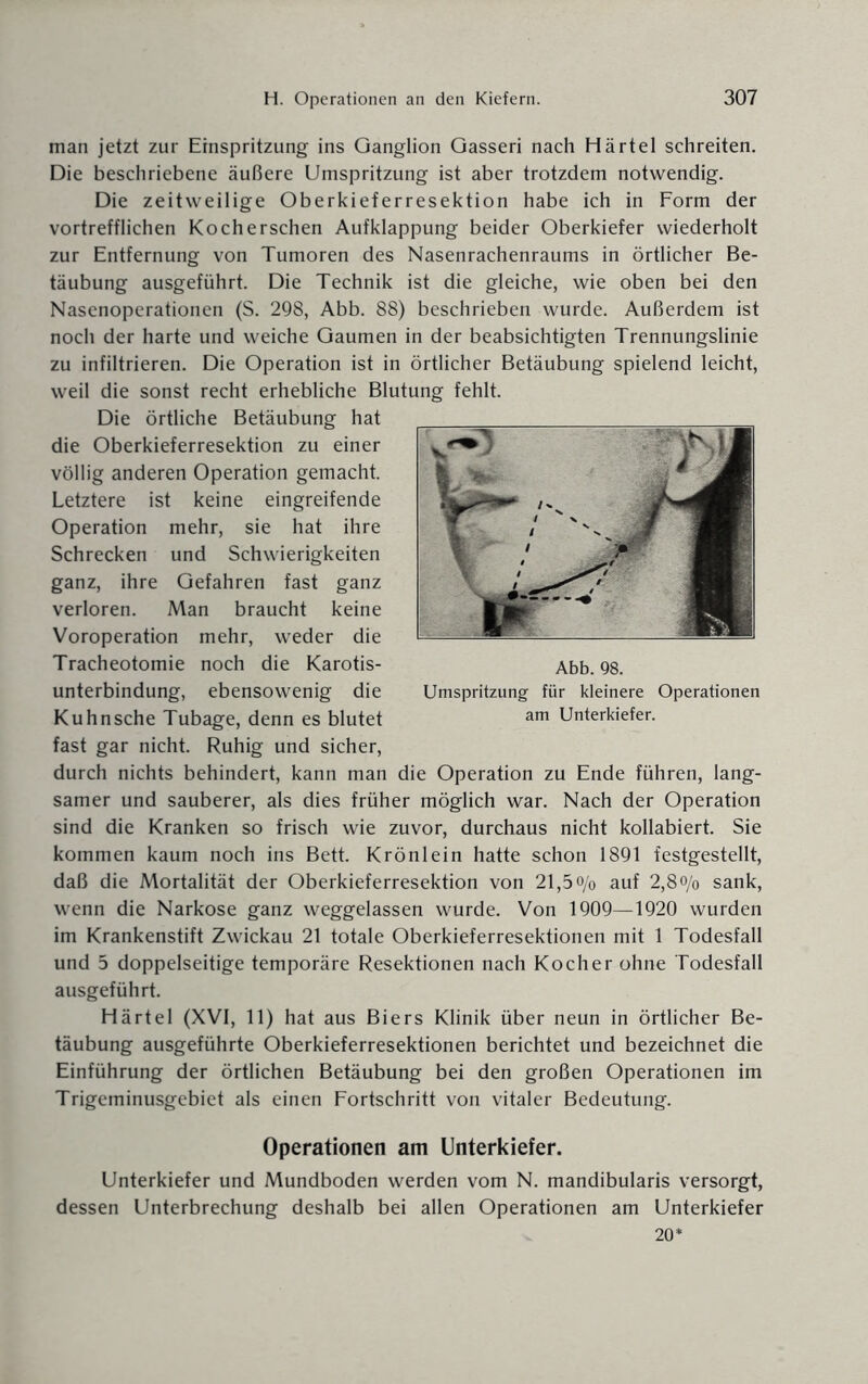 man jetzt zur Einspritzung ins Ganglion Gasseri nach Härtel schreiten. Die beschriebene äußere Umspritzung ist aber trotzdem notwendig. Die zeitweilige Oberkieferresektion habe ich in Form der vortrefflichen Ko eher sehen Aufklappung beider Oberkiefer wiederholt zur Entfernung von Tumoren des Nasenrachenraums in örtlicher Be¬ täubung ausgeführt. Die Technik ist die gleiche, wie oben bei den Nasenoperationen (S. 298, Abb. 88) beschrieben wurde. Außerdem ist noch der harte und weiche Gaumen in der beabsichtigten Trennungslinie zu infiltrieren. Die Operation ist in örtlicher Betäubung spielend leicht, weil die sonst recht erhebliche Blutung fehlt. Die örtliche Betäubung hat die Oberkieferresektion zu einer völlig anderen Operation gemacht. Letztere ist keine eingreifende Operation mehr, sie hat ihre Schrecken und Schwierigkeiten ganz, ihre Gefahren fast ganz verloren. Man braucht keine Voroperation mehr, weder die Tracheotomie noch die Karotis- unterbindung, ebensowenig die Kuhnsche Tubage, denn es blutet fast gar nicht. Ruhig und sicher, durch nichts behindert, kann man die Operation zu Ende führen, lang¬ samer und sauberer, als dies früher möglich war. Nach der Operation sind die Kranken so frisch wie zuvor, durchaus nicht kollabiert. Sie kommen kaum noch ins Bett. Krönlein hatte schon 1891 festgestellt, daß die Mortalität der Oberkieferresektion von 21,5 o/o auf 2,8o/o sank, wenn die Narkose ganz weggelassen wurde. Von 1909—1920 wurden im Krankenstift Zwickau 21 totale Oberkieferresektionen mit 1 Todesfall und 5 doppelseitige temporäre Resektionen nach Kocher ohne Todesfall ausgeführt. Härtel (XVI, 11) hat aus Biers Klinik über neun in örtlicher Be¬ täubung ausgeführte Oberkieferresektionen berichtet und bezeichnet die Einführung der örtlichen Betäubung bei den großen Operationen im Trigeminusgebiet als einen Fortschritt von vitaler Bedeutung. Operationen am Unterkiefer. Unterkiefer und Mundboden werden vom N. mandibularis versorgt, dessen Unterbrechung deshalb bei allen Operationen am Unterkiefer 20* Abb. 98. Umspritzung für kleinere Operationen am Unterkiefer.
