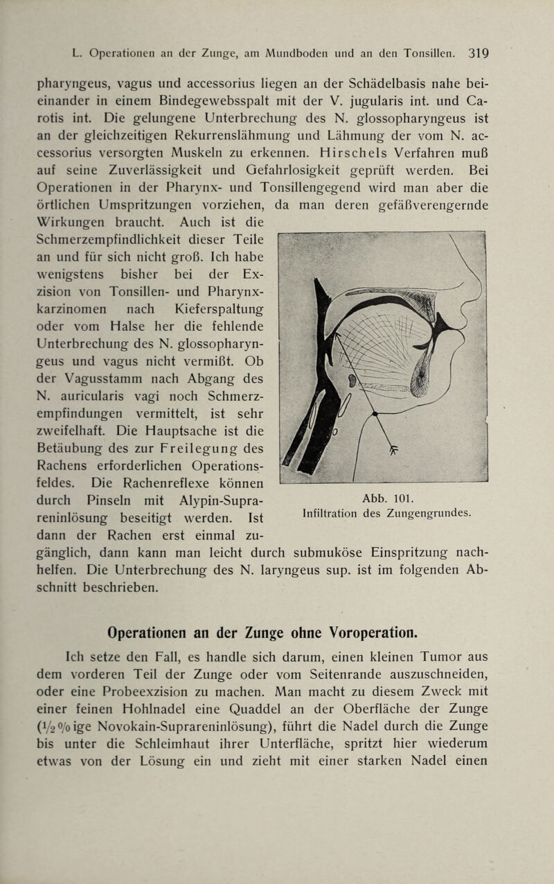 pharyngeus, vagus und accessorius liegen an der Schädelbasis nahe bei¬ einander in einem Bindegewebsspalt mit der V. jugularis int. und Ca¬ rotis int. Die gelungene Unterbrechung des N. glossopharyngeus ist an der gleichzeitigen Rekurrenslähmung und Lähmung der vom N. ac¬ cessorius versorgten Muskeln zu erkennen. Hirscheis Verfahren muß auf seine Zuverlässigkeit und Gefahrlosigkeit geprüft werden. Bei Operationen in der Pharynx- und Tonsillengegend wird man aber die örtlichen Umspritzungen vorziehen, da man deren gefäßverengernde Wirkungen braucht. Auch ist die Schmerzempfindlichkeit dieser Teile an und für sich nicht groß. Ich habe wenigstens bisher bei der Ex¬ zision von Tonsillen- und Pharynx¬ karzinomen nach Kieferspaltung oder vom Halse her die fehlende Unterbrechung des N. glossopharyn¬ geus und vagus nicht vermißt. Ob der Vagusstamm nach Abgang des N. auricularis vagi noch Schmerz¬ empfindungen vermittelt, ist sehr zweifelhaft. Die Hauptsache ist die Betäubung des zur Freilegung des Rachens erforderlichen Operations¬ feldes. Die Rachenreflexe können durch Pinseln mit Alypin-Supra- reninlösung beseitigt werden. Ist dann der Rachen erst einmal zu¬ gänglich, dann kann man leicht durch submuköse Einspritzung nach¬ helfen. Die Unterbrechung des N. laryngeus sup. ist im folgenden Ab¬ schnitt beschrieben. Operationen an der Zunge ohne Voroperation. Ich setze den Fall, es handle sich darum, einen kleinen Tumor aus dem vorderen Teil der Zunge oder vom Seitenrande auszuschneiden, oder eine Probeexzision zu machen. Man macht zu diesem Zweck mit einer feinen Hohlnadel eine Quaddel an der Oberfläche der Zunge (i/2°/oige Novokain-Suprareninlösung), führt die Nadel durch die Zunge bis unter die Schleimhaut ihrer Unterfläche, spritzt hier wiederum etwas von der Lösung ein und zieht mit einer starken Nadel einen