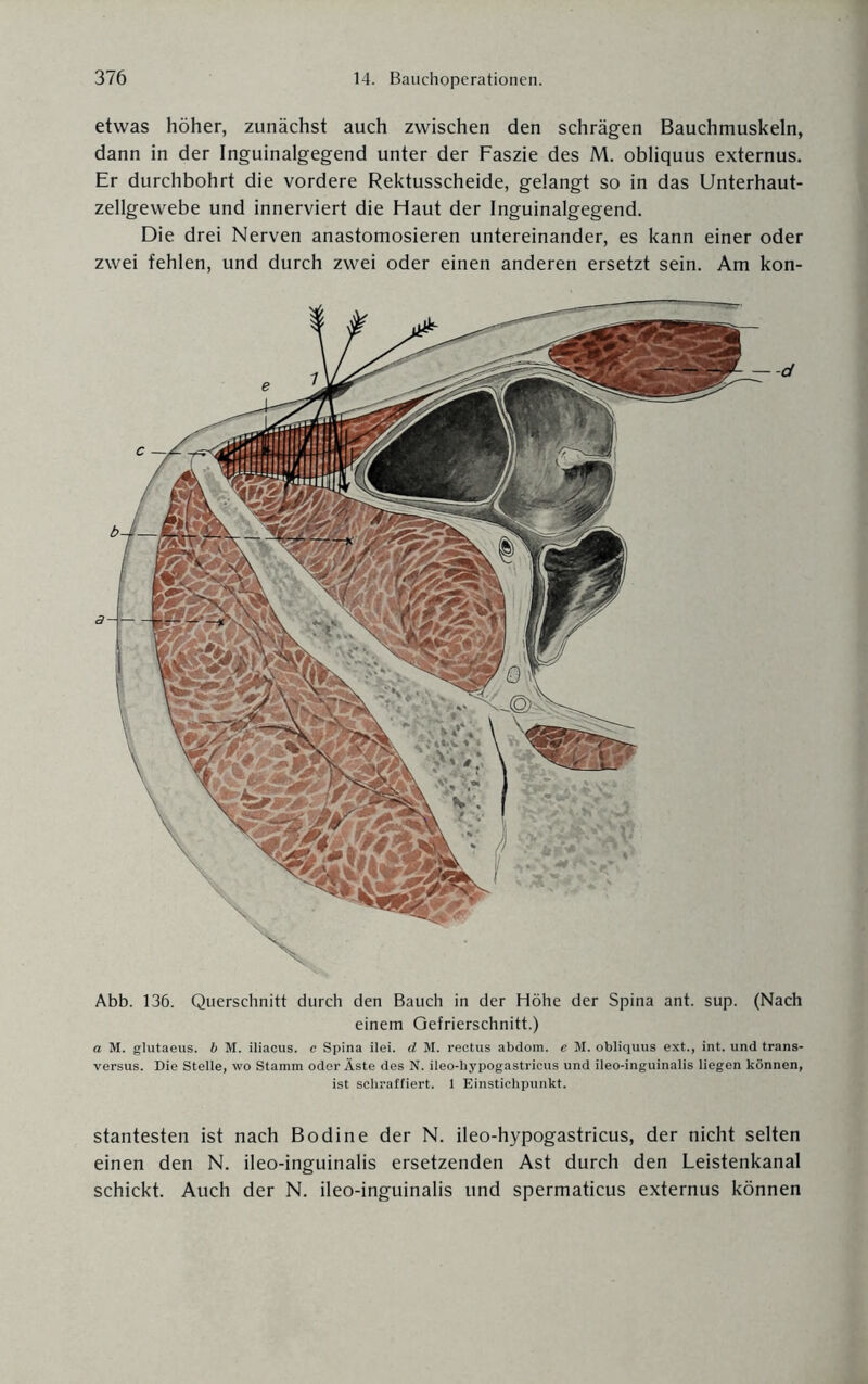 Abb. 136. Querschnitt durch den Bauch in der Höhe der Spina ant. sup. (Nach einem Gefrierschnitt.) a M. glutaeus. b M. iliacus. c Spina ilei. d M. reetus abdom. e M. obliquus ext., int. und trans- versus. Die Stelle, wo Stamm oder Äste des N. ileo-hypogastricus und ileo-inguinalis liegen können, ist schraffiert. 1 Einstichpunkt. etwas höher, zunächst auch zwischen den schrägen Bauchmuskeln, dann in der Inguinalgegend unter der Faszie des M. obliquus externus. Er durchbohrt die vordere Rektusscheide, gelangt so in das Unterhaut¬ zellgewebe und innerviert die Haut der Inguinalgegend. Die drei Nerven anastomosieren untereinander, es kann einer oder zwei fehlen, und durch zwei oder einen anderen ersetzt sein. Am kon- -d stantesten ist nach Bo di ne der N. ileo-hypogastricus, der nicht selten einen den N. ileo-inguinalis ersetzenden Ast durch den Leistenkanal schickt. Auch der N. ileo-inguinalis und spermaticus externus können