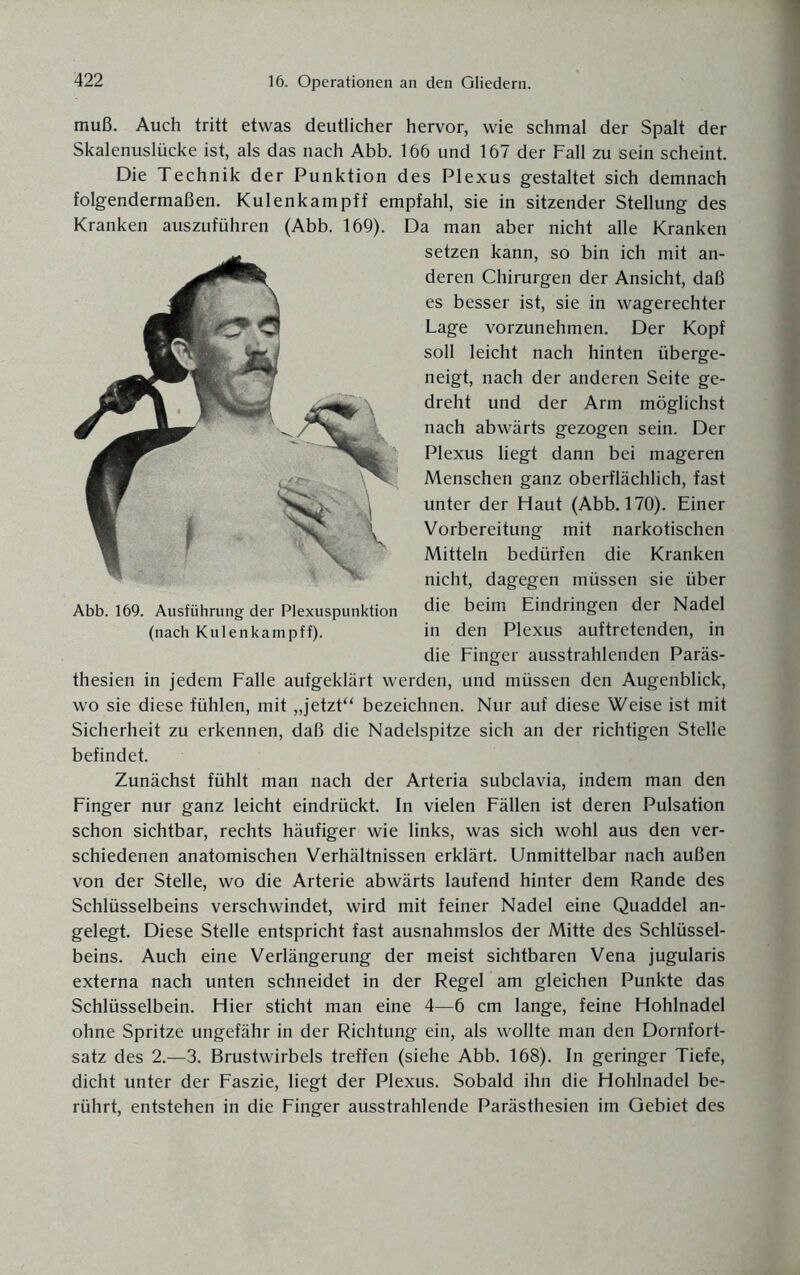muß. Auch tritt etwas deutlicher hervor, wie schmal der Spalt der Skalenuslücke ist, als das nach Abb. 166 und 167 der Fall zu sein scheint. Die Technik der Punktion des Plexus gestaltet sich demnach folgendermaßen. Kulenkampff empfahl, sie in sitzender Stellung des Kranken auszuführen (Abb. 169). Da man aber nicht alle Kranken setzen kann, so bin ich mit an¬ deren Chirurgen der Ansicht, daß es besser ist, sie in wagerechter Lage vorzunehmen. Der Kopf soll leicht nach hinten überge¬ neigt, nach der anderen Seite ge¬ dreht und der Arm möglichst nach abwärts gezogen sein. Der Plexus liegt dann bei mageren Menschen ganz oberflächlich, fast unter der Haut (Abb. 170). Einer Vorbereitung mit narkotischen Mitteln bedürfen die Kranken nicht, dagegen müssen sie über die beim Eindringen der Nadel in den Plexus auftretenden, in die Finger ausstrahlenden Paräs- thesien in jedem Falle aufgeklärt werden, und müssen den Augenblick, wo sie diese fühlen, mit „jetzt“ bezeichnen. Nur auf diese Weise ist mit Sicherheit zu erkennen, daß die Nadelspitze sich an der richtigen Stelle befindet. Zunächst fühlt man nach der Arteria subclavia, indem man den Finger nur ganz leicht eindrückt. In vielen Fällen ist deren Pulsation schon sichtbar, rechts häufiger wie links, was sich wohl aus den ver¬ schiedenen anatomischen Verhältnissen erklärt. Unmittelbar nach außen von der Stelle, wo die Arterie abwärts laufend hinter dem Rande des Schlüsselbeins verschwindet, wird mit feiner Nadel eine Quaddel an¬ gelegt. Diese Stelle entspricht fast ausnahmslos der Mitte des Schlüssel¬ beins. Auch eine Verlängerung der meist sichtbaren Vena jugularis externa nach unten schneidet in der Regel am gleichen Punkte das Schlüsselbein. Hier sticht man eine 4—6 cm lange, feine Hohlnadel ohne Spritze ungefähr in der Richtung ein, als wollte man den Dornfort¬ satz des 2.—3. Brustwirbels treffen (siehe Abb. 168). In geringer Tiefe, dicht unter der Faszie, liegt der Plexus. Sobald ihn die Hohlnadel be¬ rührt, entstehen in die Finger ausstrahlende Parästhesien im Gebiet des Abb. 169. Ausführung der Plexuspunktion (nach Kulenkampff).