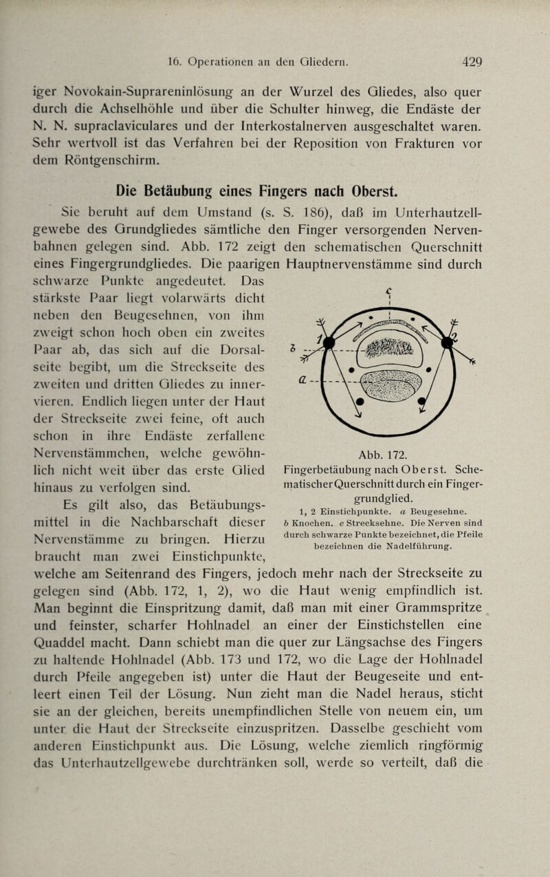 iger Novokain-Suprareninlösung an der Wurzel des Gliedes, also quer durch die Achselhöhle und über die Schulter hinweg, die Endäste der N. N. supraclaviculares und der Interkostalnerven ausgeschaltet waren. Sehr wertvoll ist das Verfahren bei der Reposition von Frakturen vor dem Röntgenschirm. Die Betäubung eines Fingers nach Oberst. Sie beruht auf dem Umstand (s. S. 186), daß im Unterhautzell¬ gewebe des Grundgliedes sämtliche den Finger versorgenden Nerven¬ bahnen gelegen sind. Abb. 172 zeigt den schematischen Querschnitt eines Fingergrundgliedes. Die paarigen Hauptnervenstämme sind durch schwarze Punkte angedeutet. Das stärkste Paar liegt volarwärts dicht neben den Beugesehnen, von ihm zweigt schon hoch oben ein zweites Paar ab, das sich auf die Dorsal¬ seite begibt, um die Streckseite des zweiten und dritten Gliedes zu inner- vieren. Endlich liegen unter der Haut der Streckseite zwei feine, oft auch schon in ihre Endäste zerfallene Nervenstämmchen, welche gewöhn¬ lich nicht weit über das erste Glied hinaus zu verfolgen sind. Es gilt also, das Betäubungs¬ mittel in die Nachbarschaft dieser Nervenstämme zu bringen. Hierzu braucht man zwei Einstichpunkte, welche am Seitenrand des Fingers, jedoch mehr nach der Streckseite zu gelegen sind (Abb. 172, 1, 2), wo die Haut wenig empfindlich ist. Man beginnt die Einspritzung damit, daß man mit einer Grammspritze und feinster, scharfer Hohlnadel an einer der Einstichstellen eine Quaddel macht. Dann schiebt man die quer zur Längsachse des Fingers zu haltende Hohlnadel (Abb. 173 und 172, wo die Lage der Hohlnadel durch Pfeile angegeben ist) unter die Haut der Beugeseite und ent¬ leert einen Teil der Lösung. Nun zieht man die Nadel heraus, sticht sie an der gleichen, bereits unempfindlichen Stelle von neuem ein, um unter die Haut der Streckseite einzuspritzen. Dasselbe geschieht vom anderen Einstichpunkt aus. Die Lösung, welche ziemlich ringförmig das Unterhautzellgewebe durchtränken soll, werde so verteilt, daß die c Abb. 172. Fingerbetäubung nach Oberst. Sche- matischerQuerschnitt durch ein Finger¬ grundglied. 1, 2 Einstichpunkte, a Beugesehne. b Knochen, c Strecksehne. Die Nerven sind durch schwarze Punkte bezeichnet, die Pfeile bezeichnen die Nadelführung.